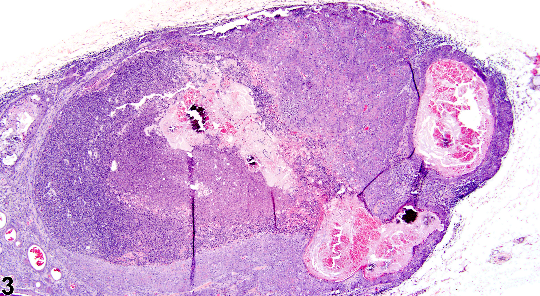 Image of inflammation, suppurative in the clitoral gland from a female F344/N rat in a chronic study