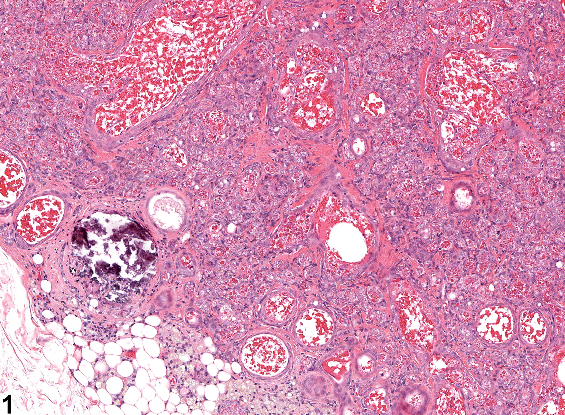 Image of mineral in the clitoral gland from a female F344/N rat in a chronic study
