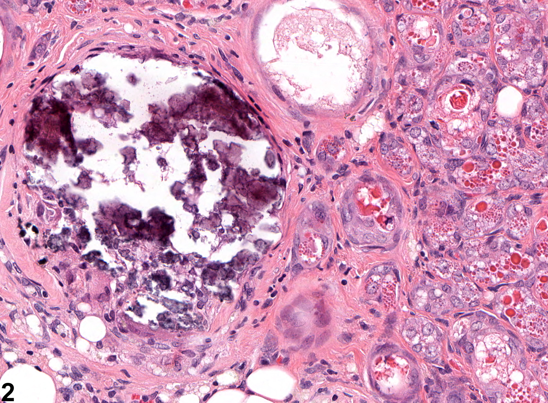 Image of mineral in the clitoral gland from a female F344/N rat in a chronic study