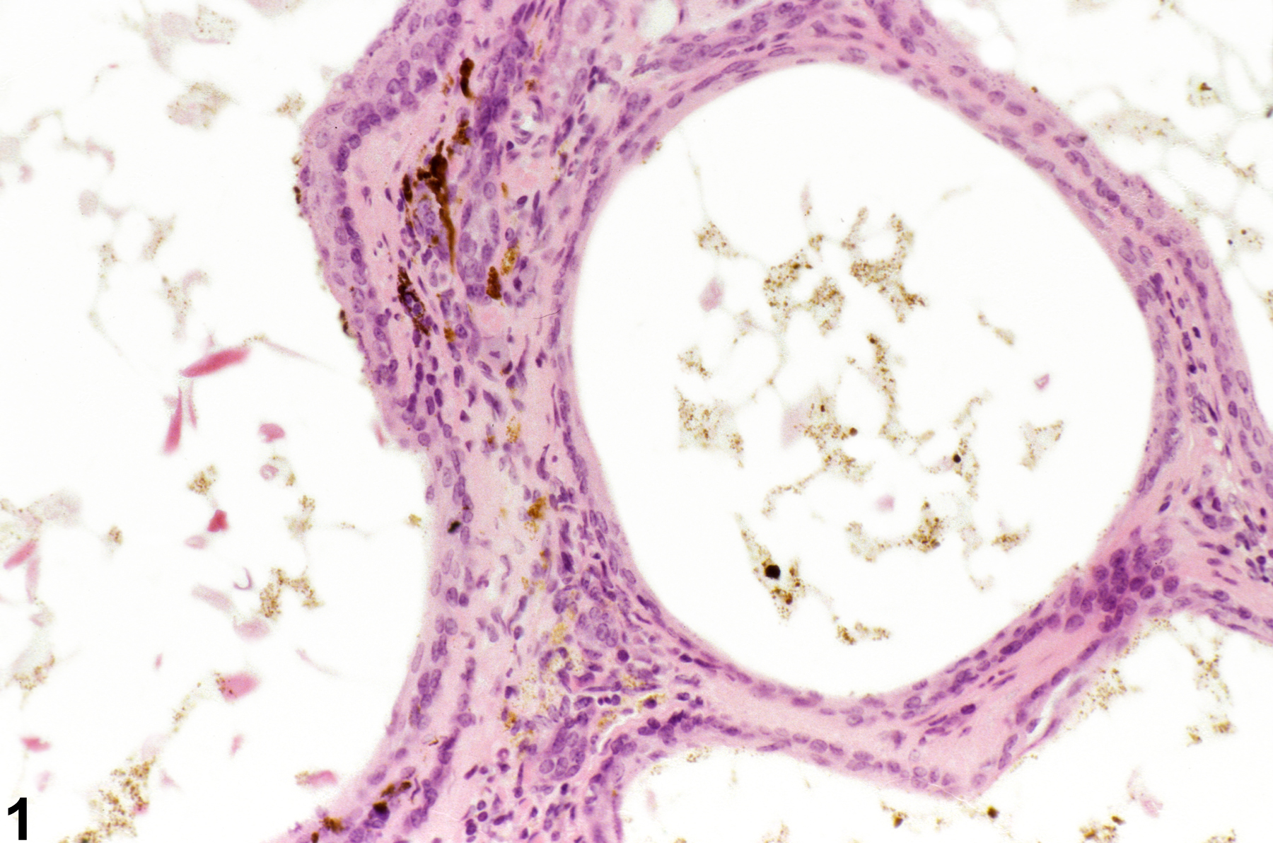 Image of pigment in the clitoral gland from a female B6C3F1 mouse in a chronic study