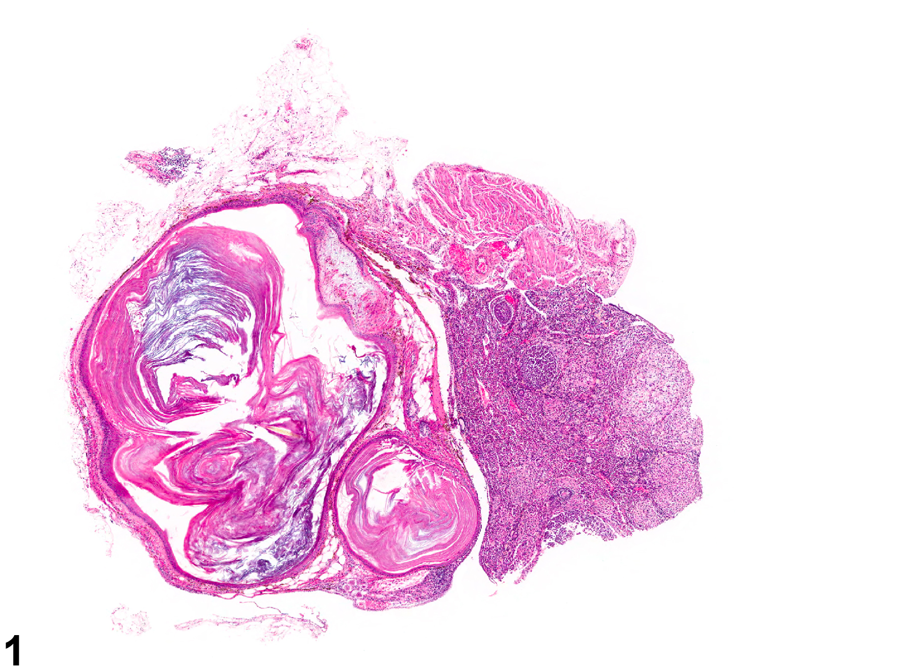Image of cyst, epithelial in the ovary from a female B6C3F1 mouse in a chronic study
