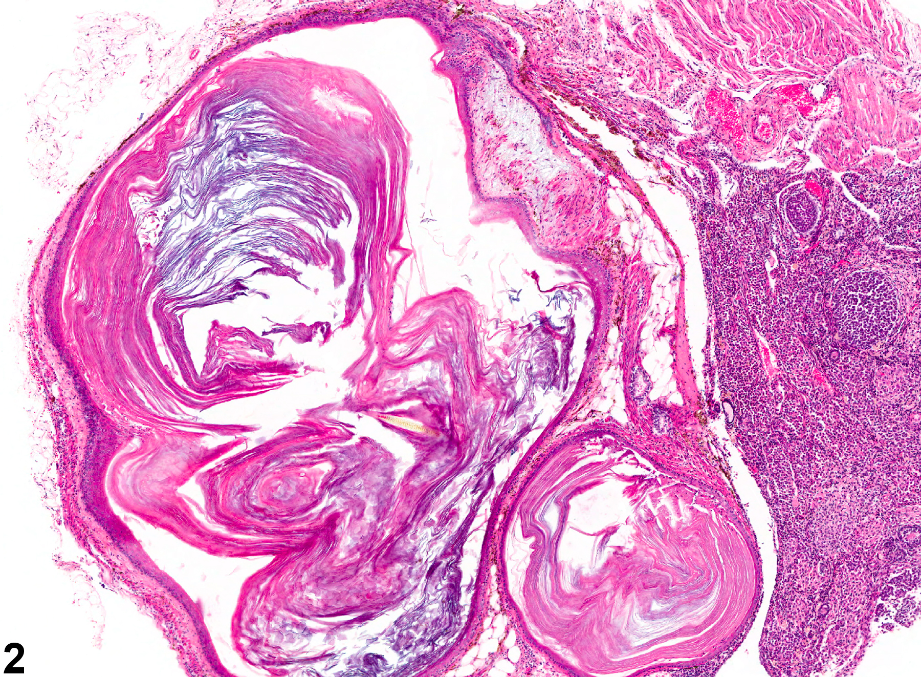 Image of cyst, epithelial in the ovary from a female B6C3F1 mouse in a chronic study