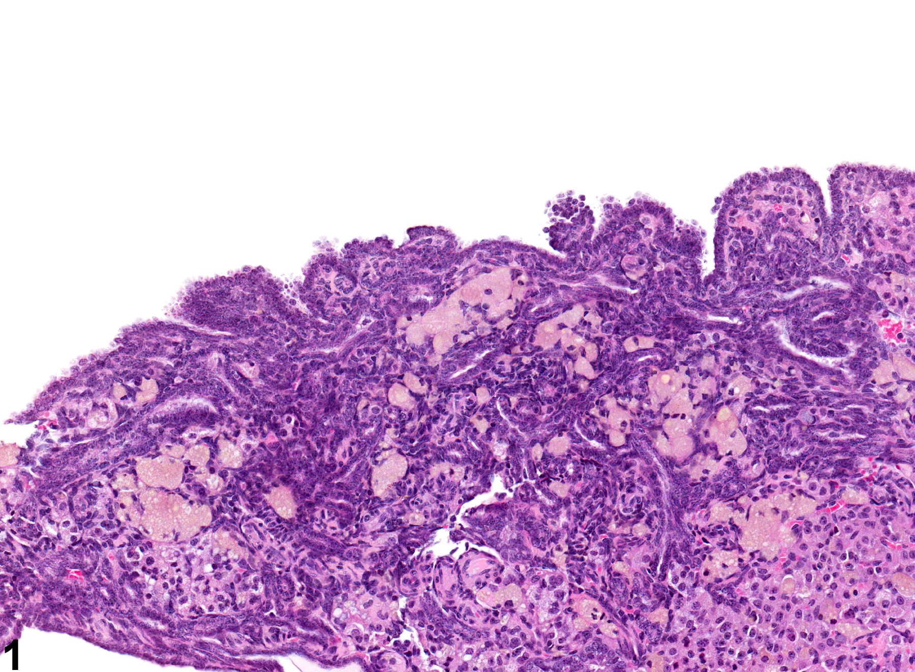 Image of epithelial hyperplasia in the ovary from a female F344/N rat in a chronic study
