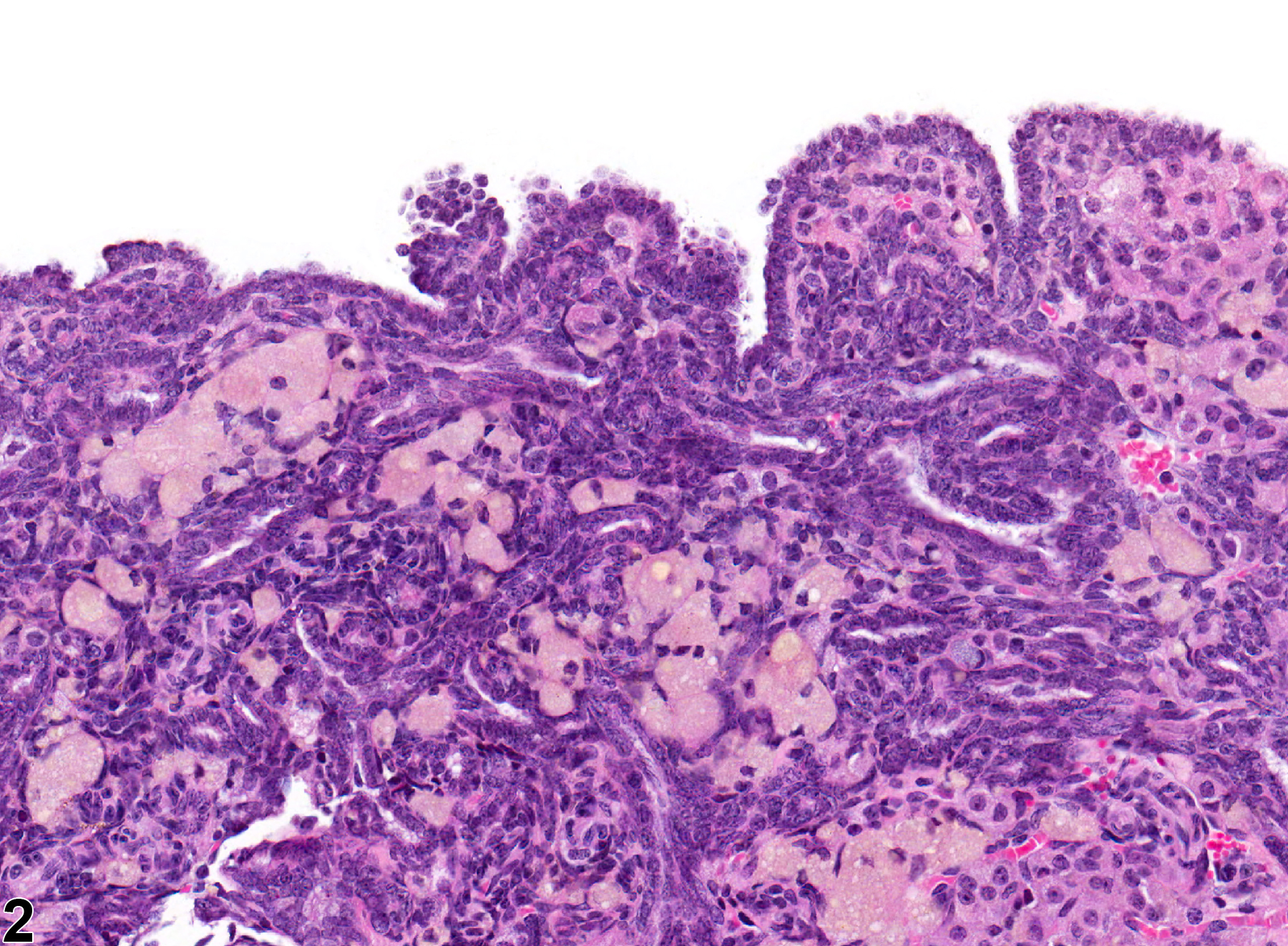 Image of epithelial hyperplasia in the ovary from a female F344/N rat in a chronic study