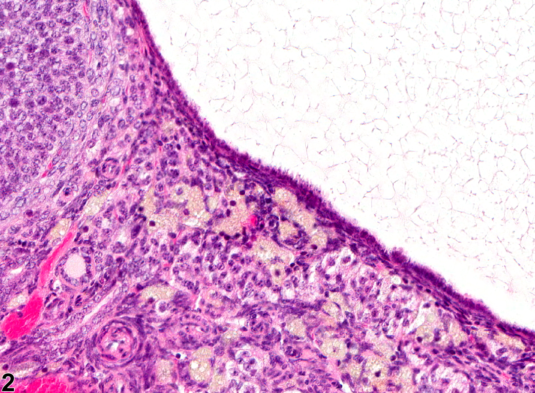 Image of follicular cyst in the ovary from a female B6C3F1 mouse in a chronic study