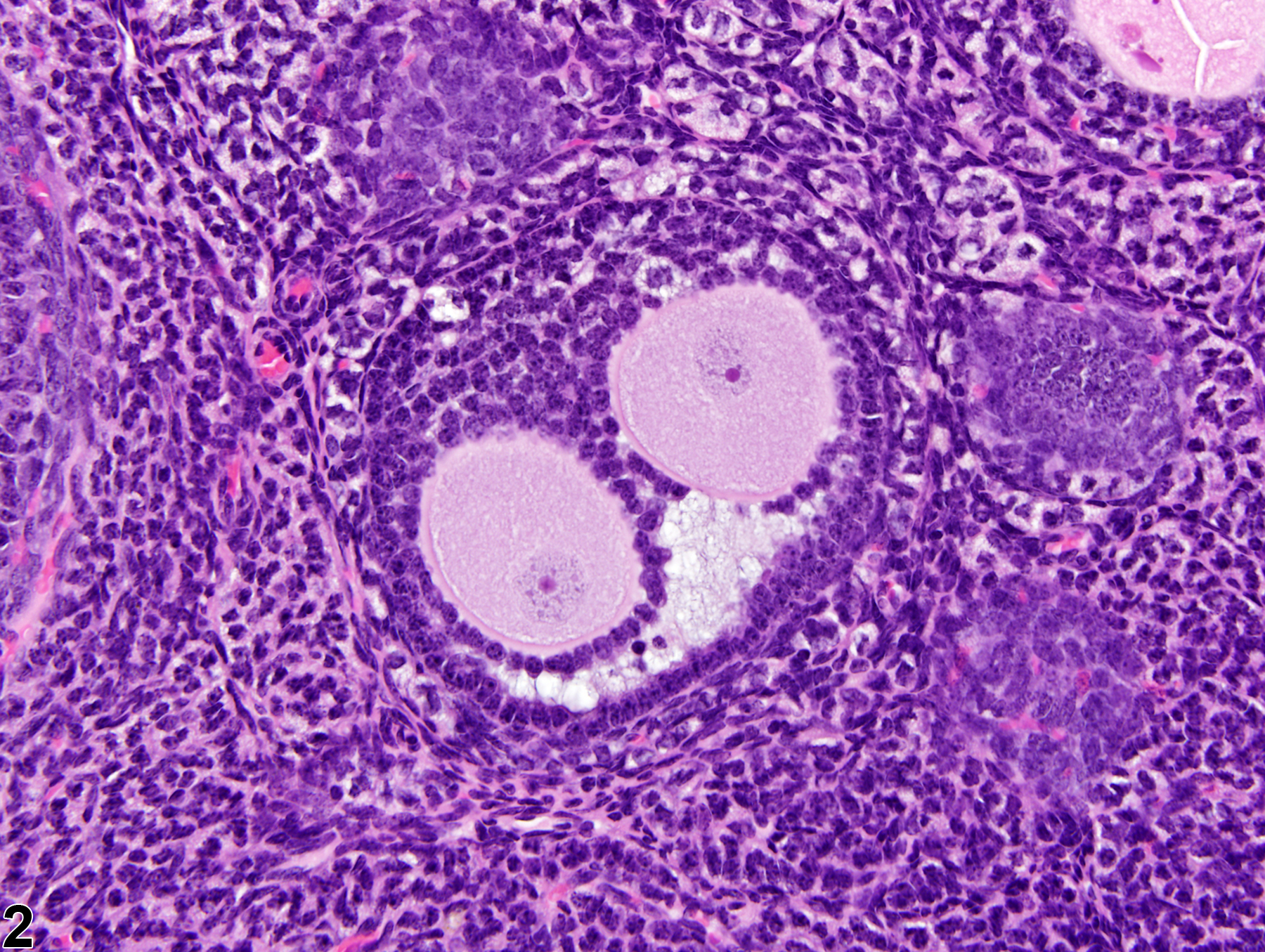 Image of polyovular follicle in the ovary from a female B6C3F1 mouse in a subchronic study