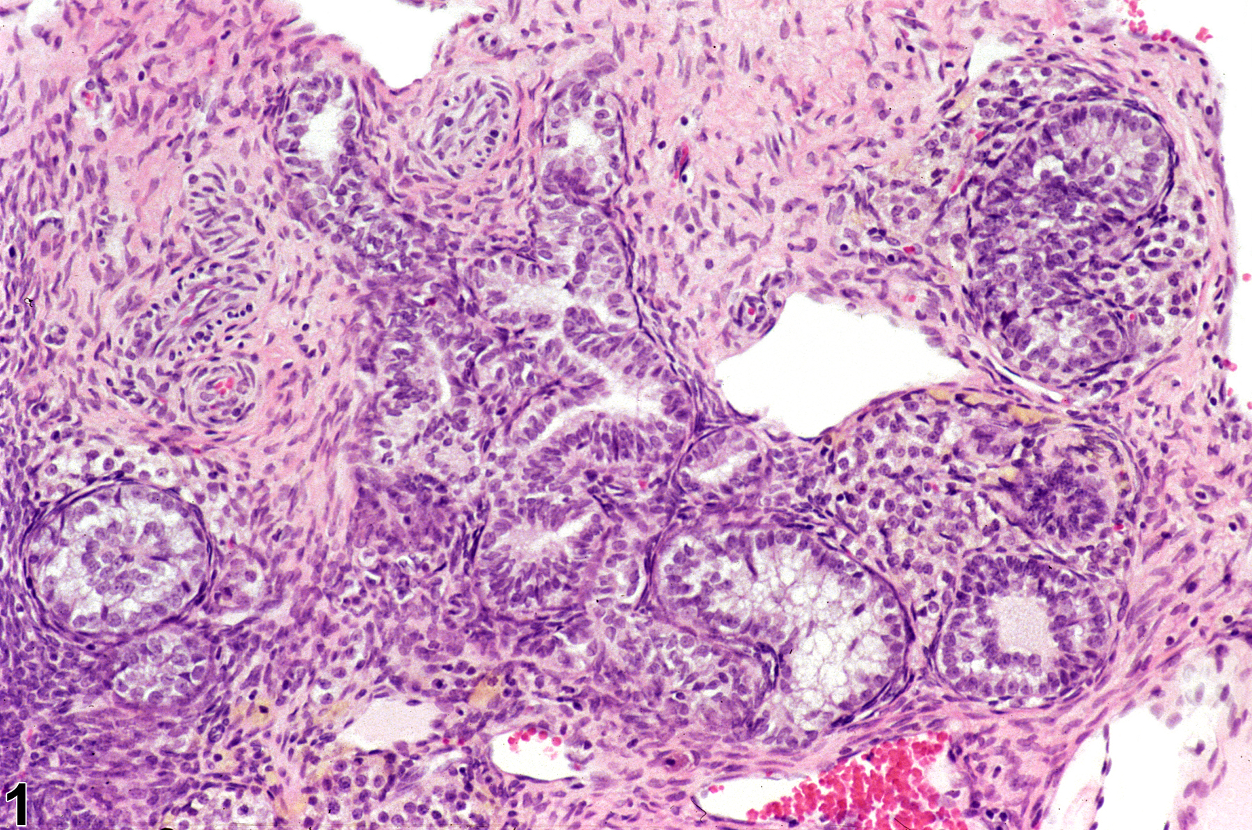 Image of hyperplasia, sertoliform in the ovary from a female F344/N rat in a chronic study