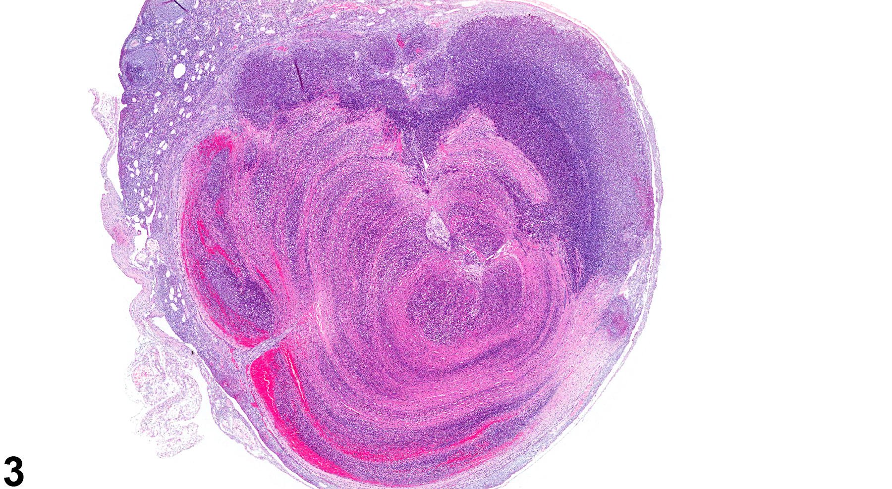 Image of inflammation, suppurative in the ovary from a female Swiss CD-1 mouse in a chronic study