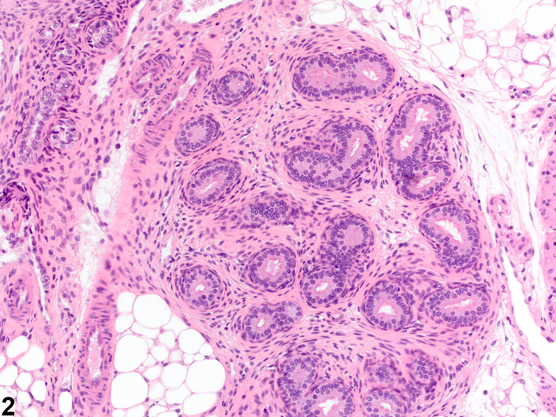 Image of mesonephric duct remnant in the ovary from a female Wistar Han rat in a subchronic study