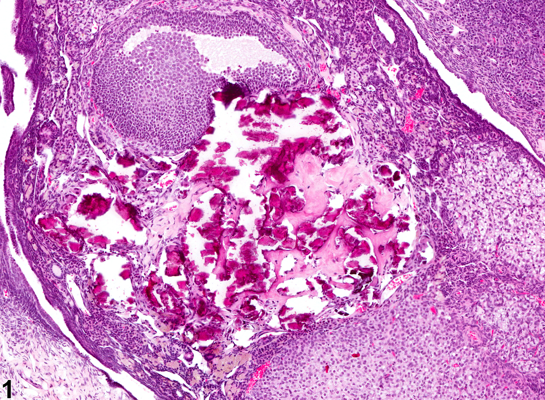 Image of metaplasia, osseous in the ovary from a female B6C3F1 mouse in a chronic study