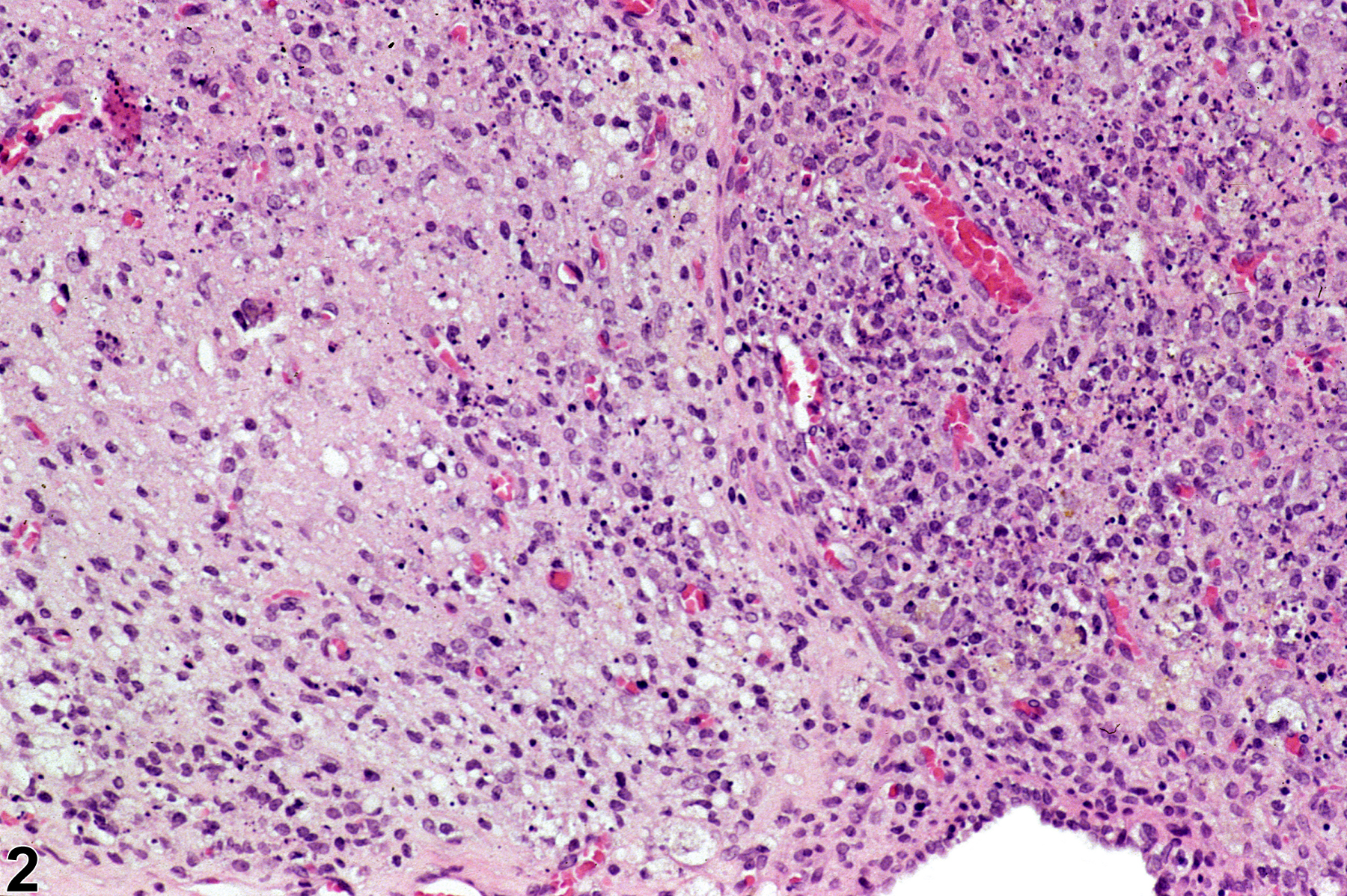 Image of necrosis in the ovary from a female F344/N rat in a chronic study