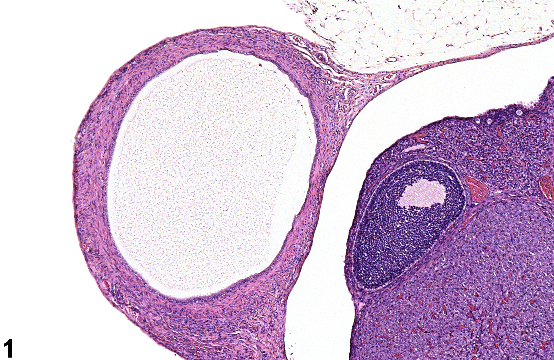 Image of cyst (paraovarian tissue) in the ovary from a female F344/N rat in a subchronic study