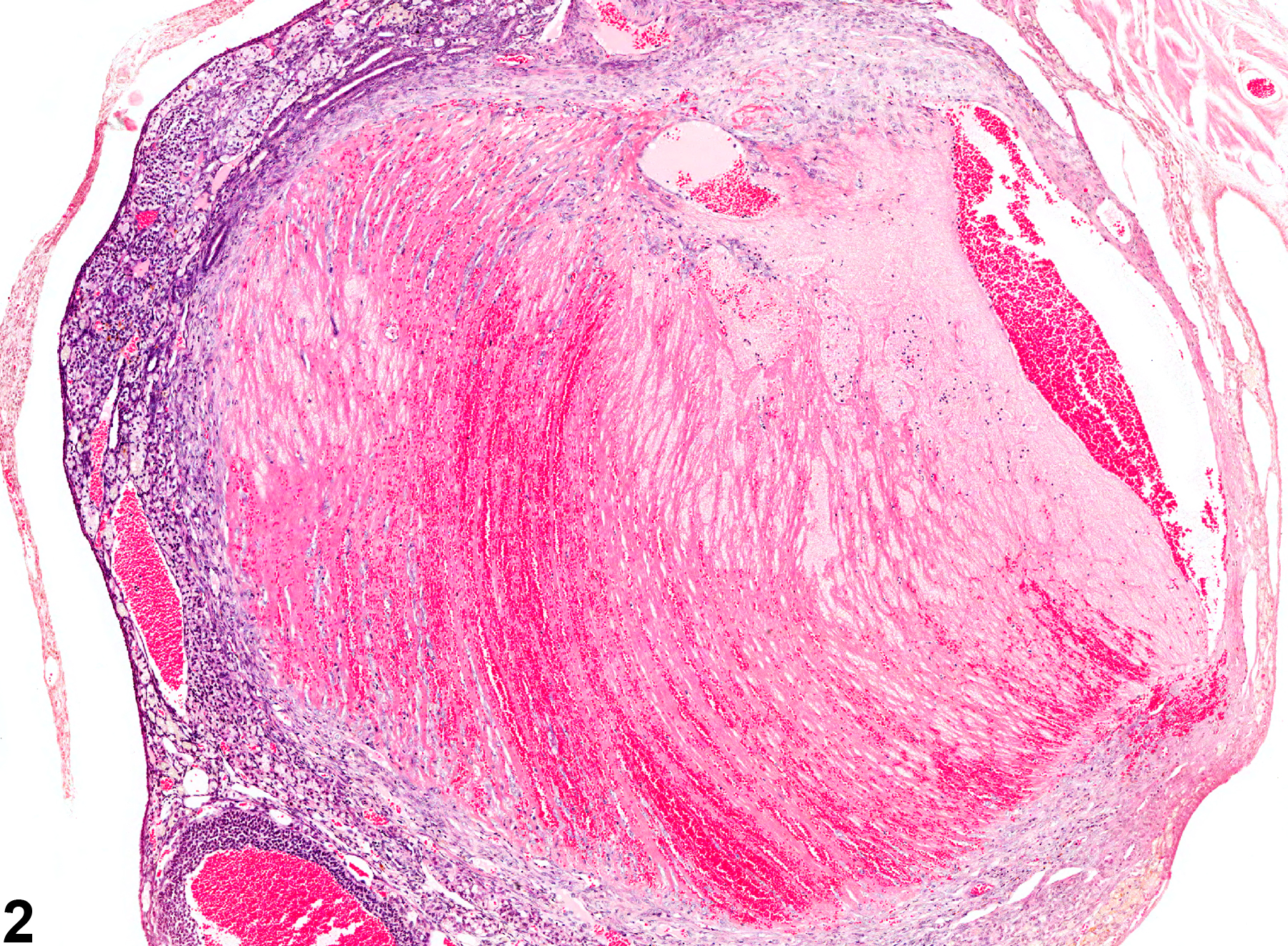 Image of thrombosis in the ovary from a female B6C3F1 mouse in a chronic study