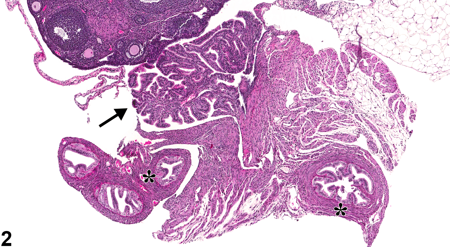 Image of atrophy in the oviduct from a female B6C3F1 mouse in a chronic study