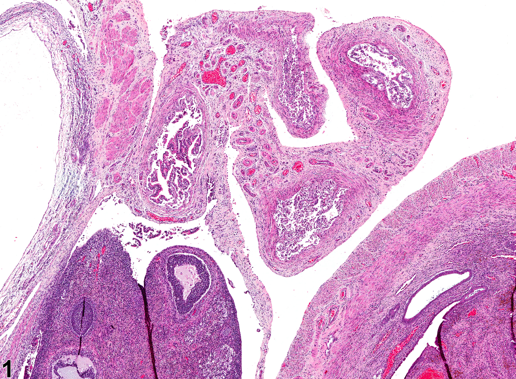 Image of necrosis in the oviduct from a female Harlan Sprague-Dawley rat in a chronic study