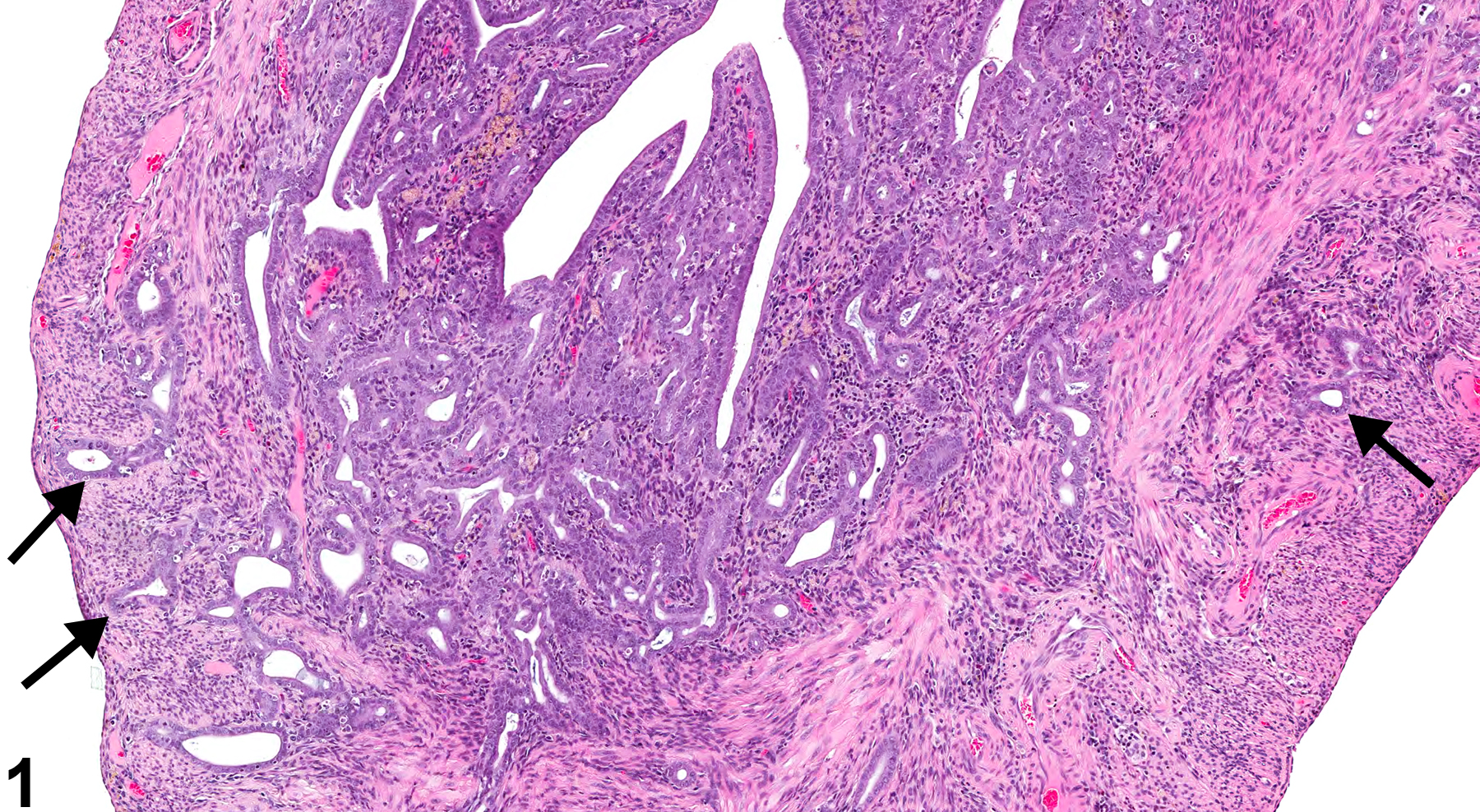 Image of adenomyosis in the uterus from a female Harlan Sprague-Dawley rat in a chronic study