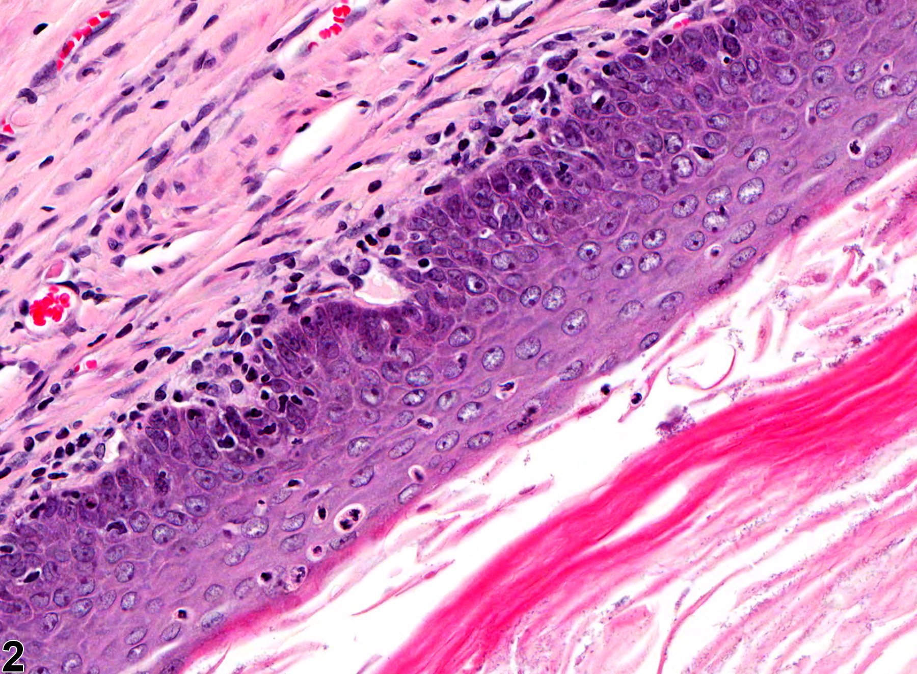 Image of cyst, squamous in the uterus from a female F344/N rat in a chronic study