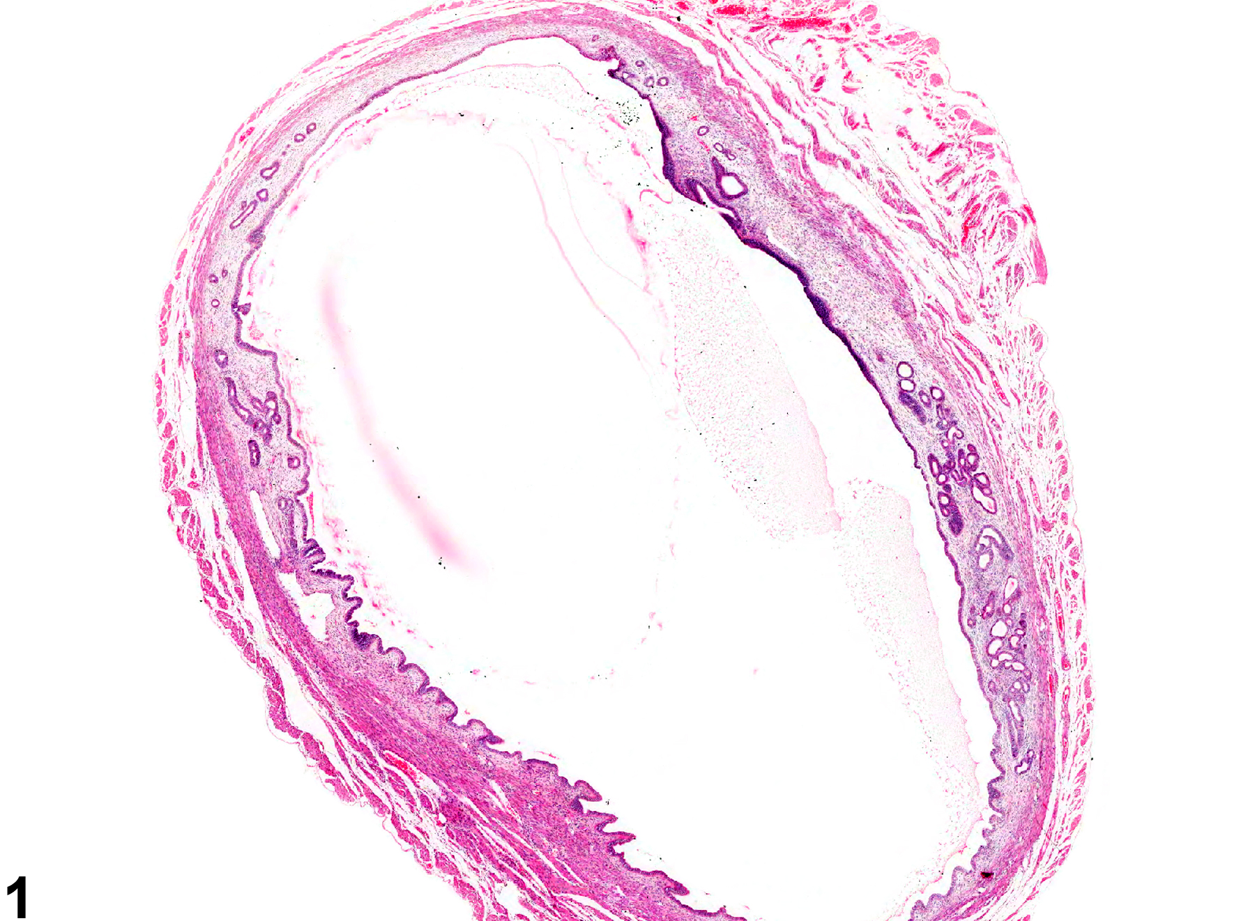 Image of dilation in the uterus from a female B6C3F1 mouse in a chronic study