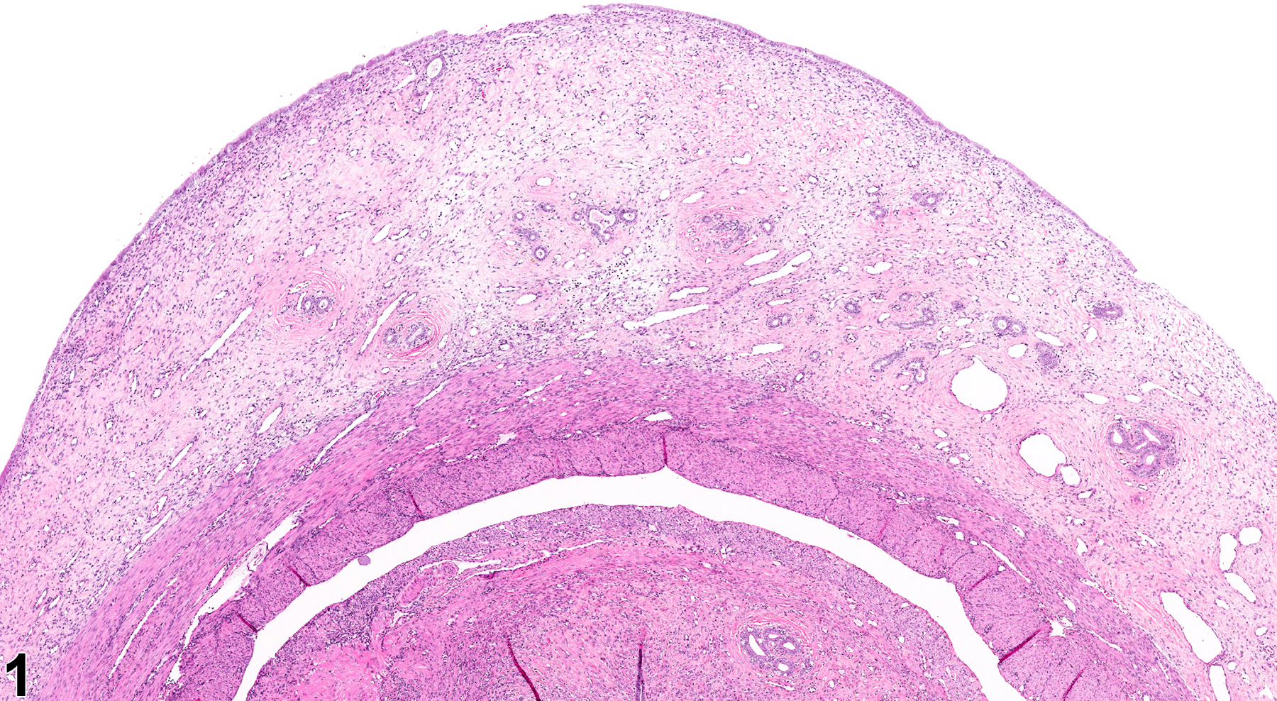 Image of edema in the uterus from a female F344/N rat in a chronic study
