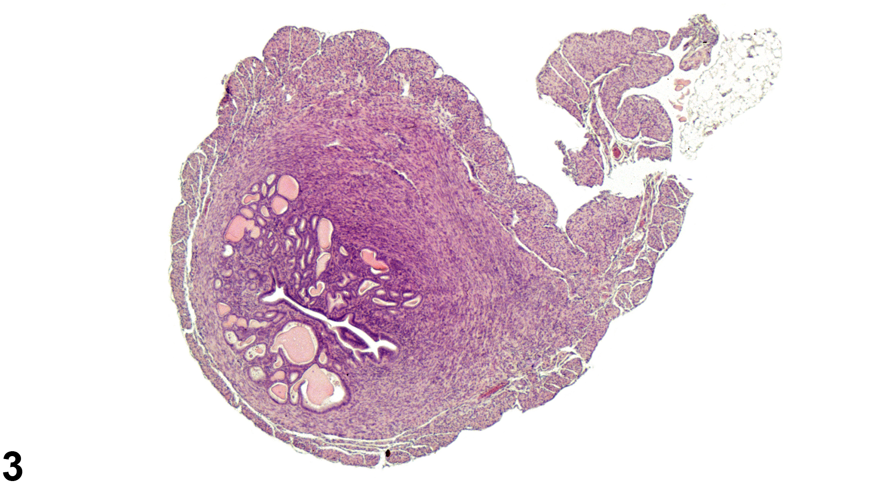 Image of hyperplasia, cystic (CEH) in the uterus from a female B6C3F1 mouse in a chronic study