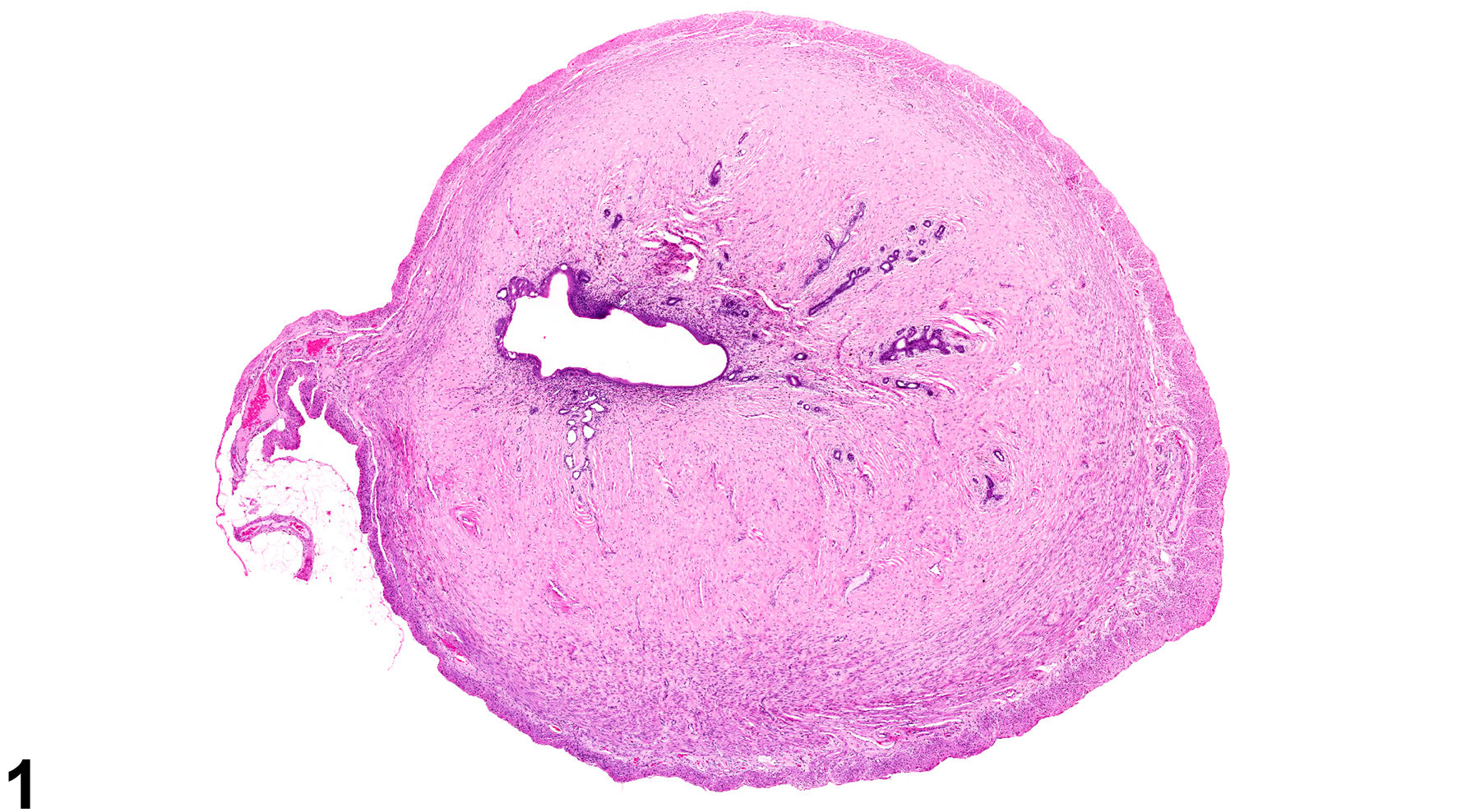 Image of fibrosis in the uterus from a female F344/N rat in a chronic study