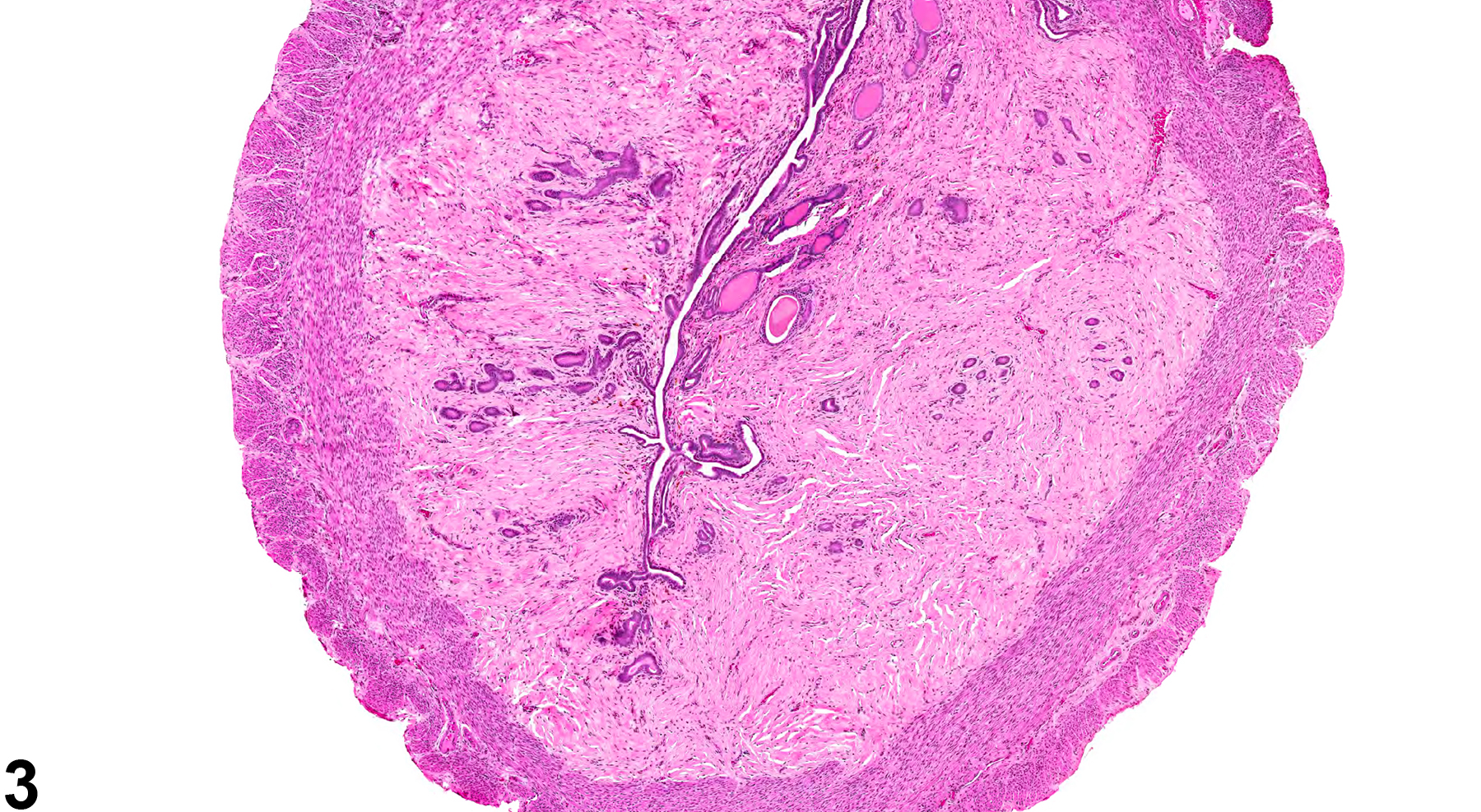 Image of fibrosis in the uterus from a female F344/N rat in a chronic study