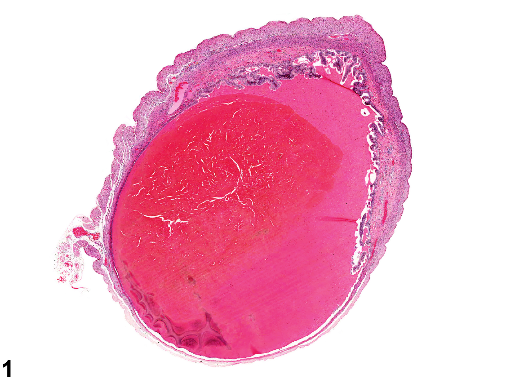 Image of hemorrhage in the uterus from a female F344/N rat in a chronic study