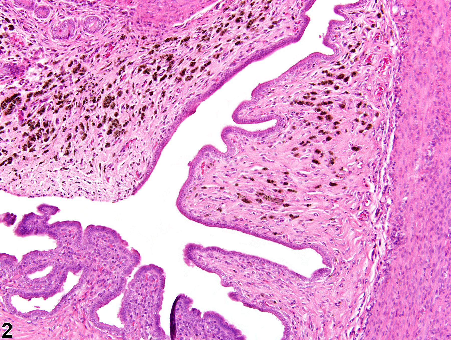 Image of pigment in the uterus from a female F344/N rat in a chronic study