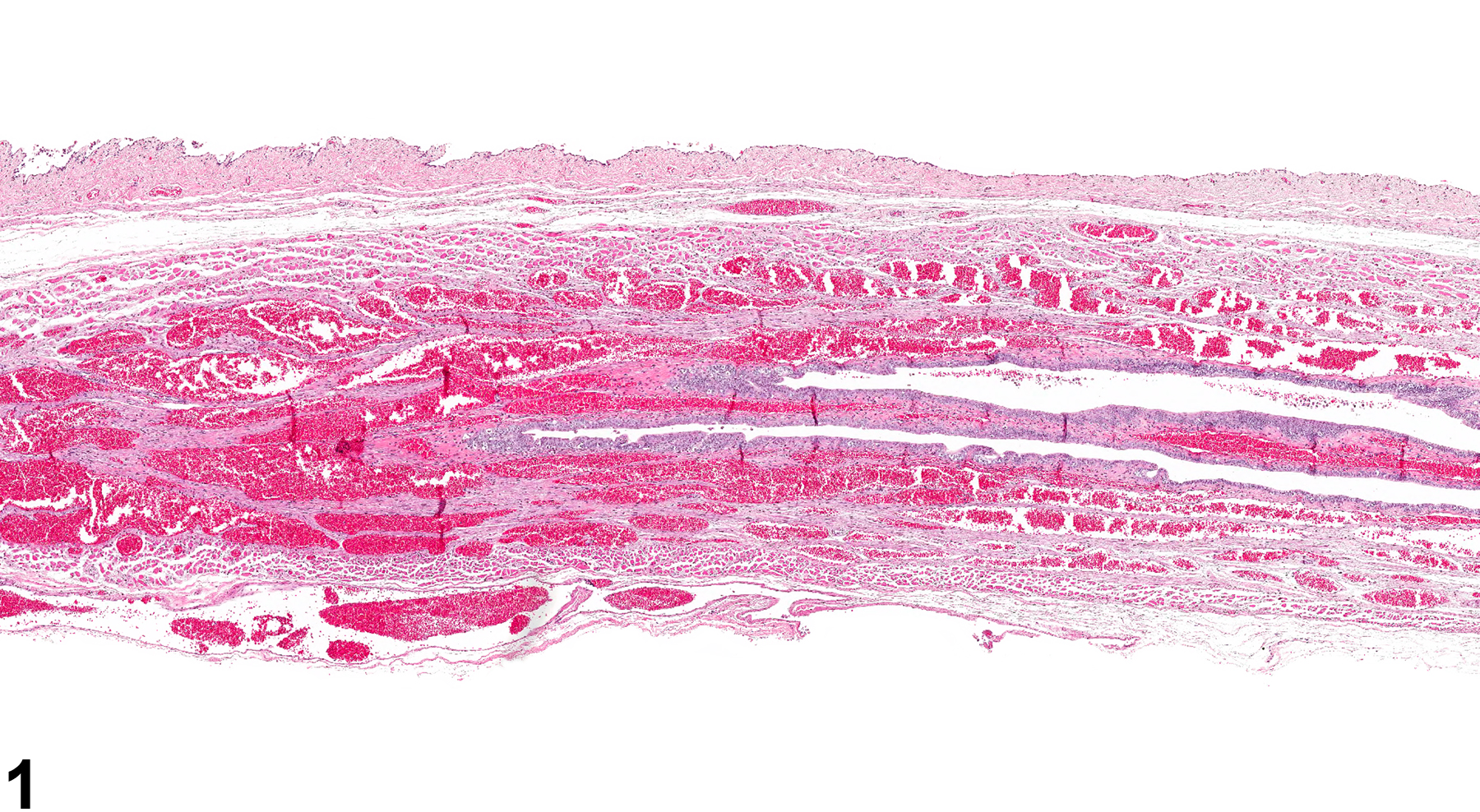 Image of angiectasis in the vagina from a female F344/N rat in a chronic study