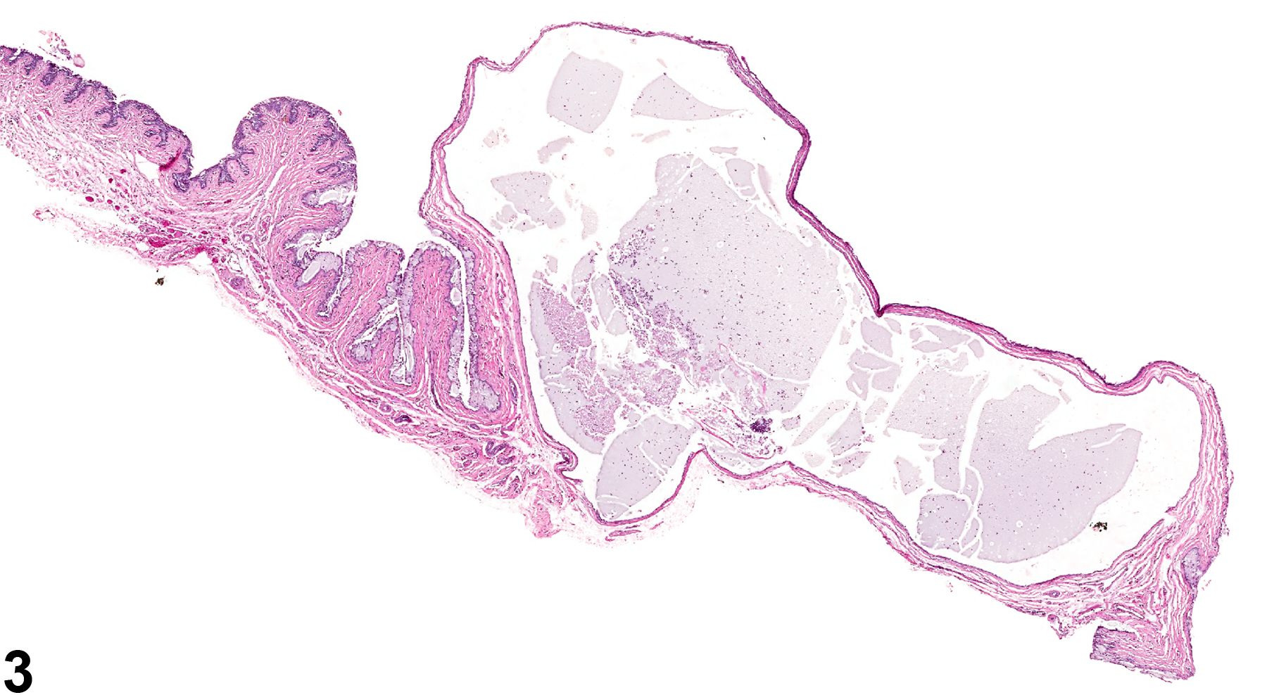 Image of cyst in the vagina from a female F344/N rat in a chronic study