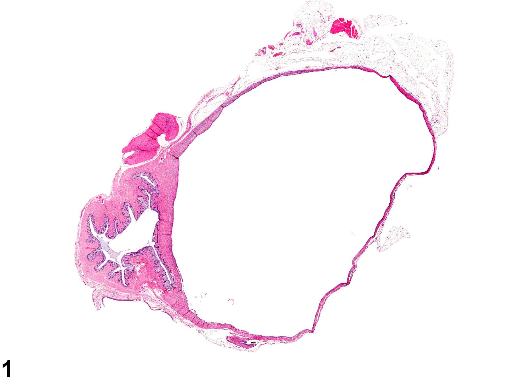 Image of dilation in the vagina from a female F344/N rat in a chronic study