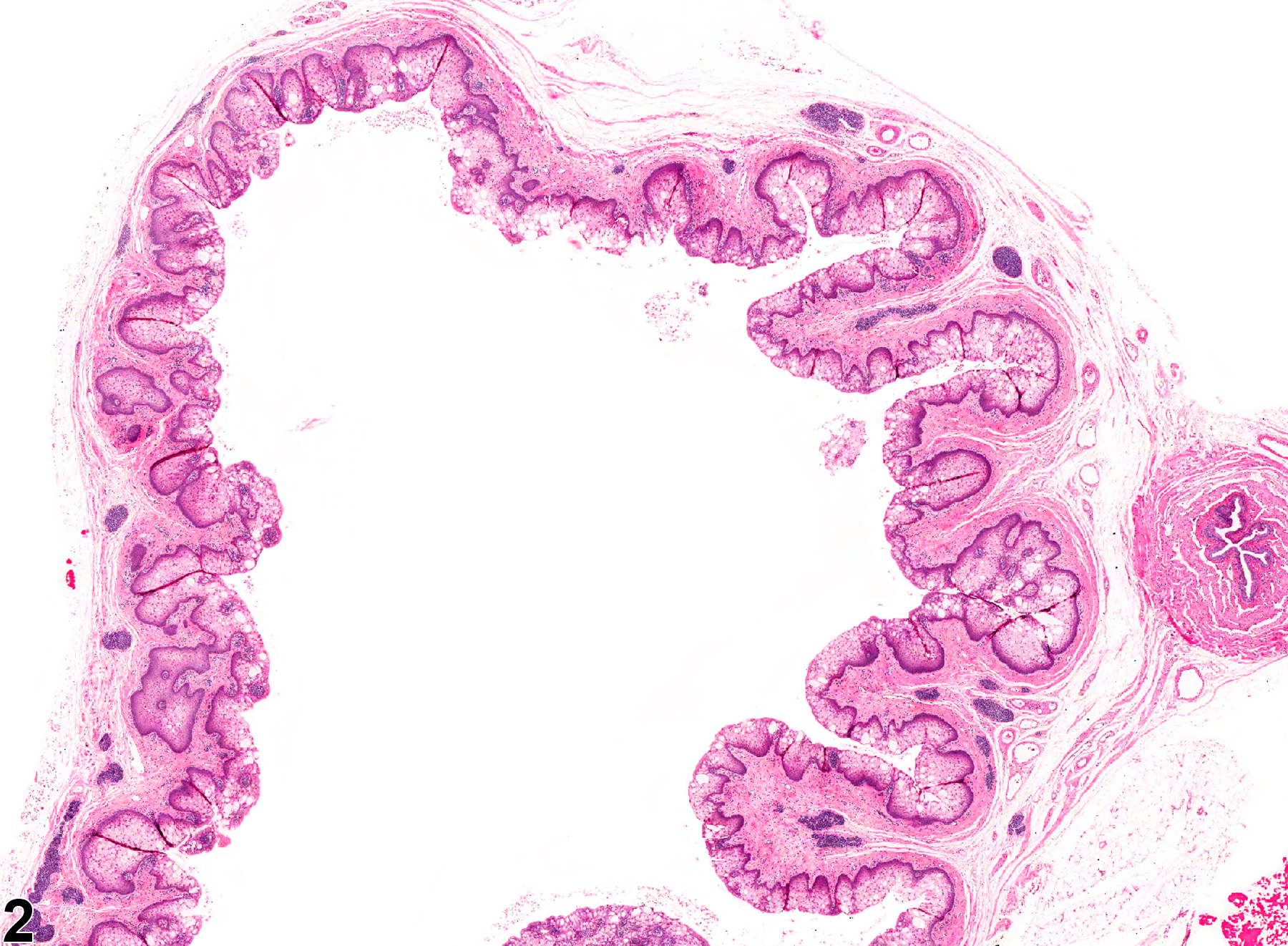 Image of dilation in the vagina from a female F344/N rat in a chronic study