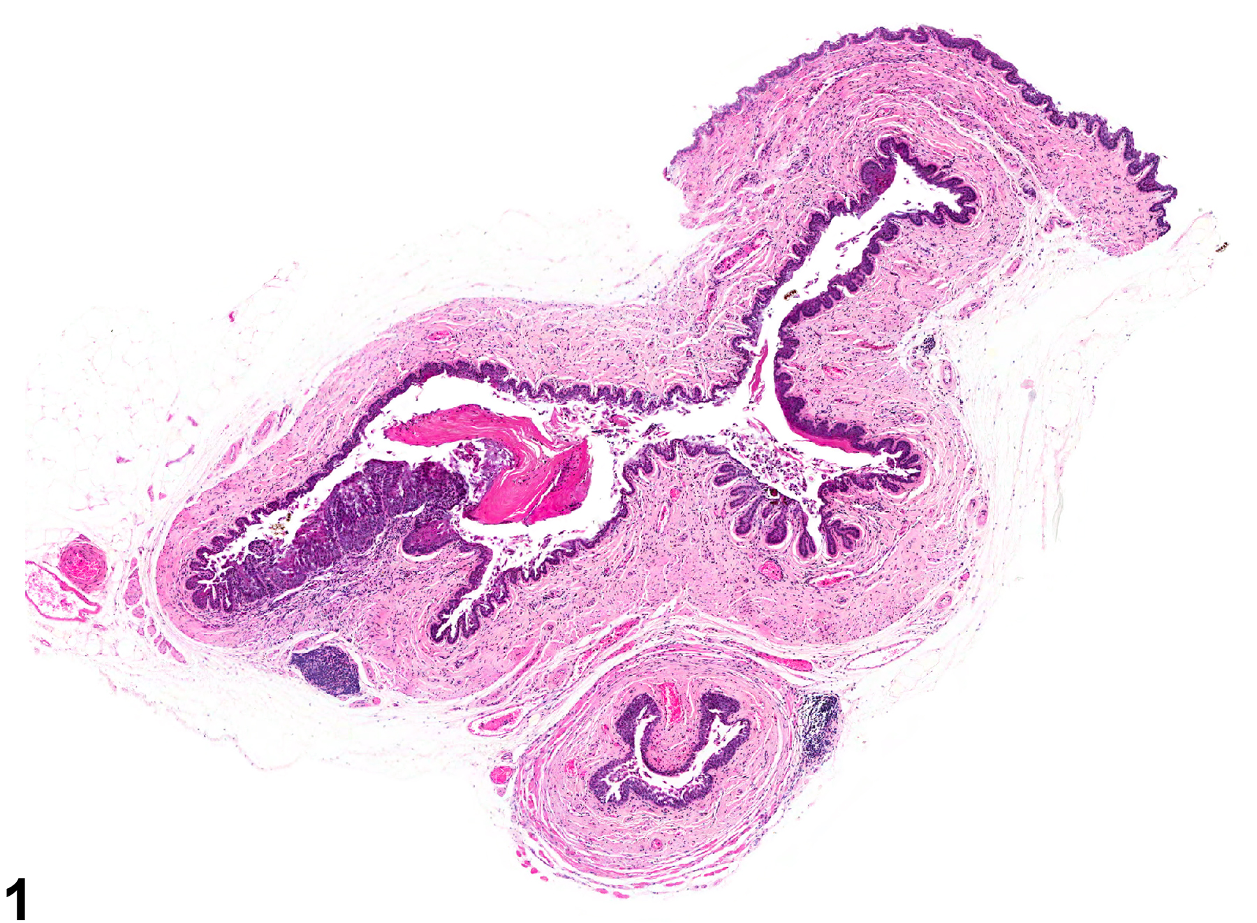 Image of hyperplasia in the vagina from a female B6C3F1 mouse in a chronic study