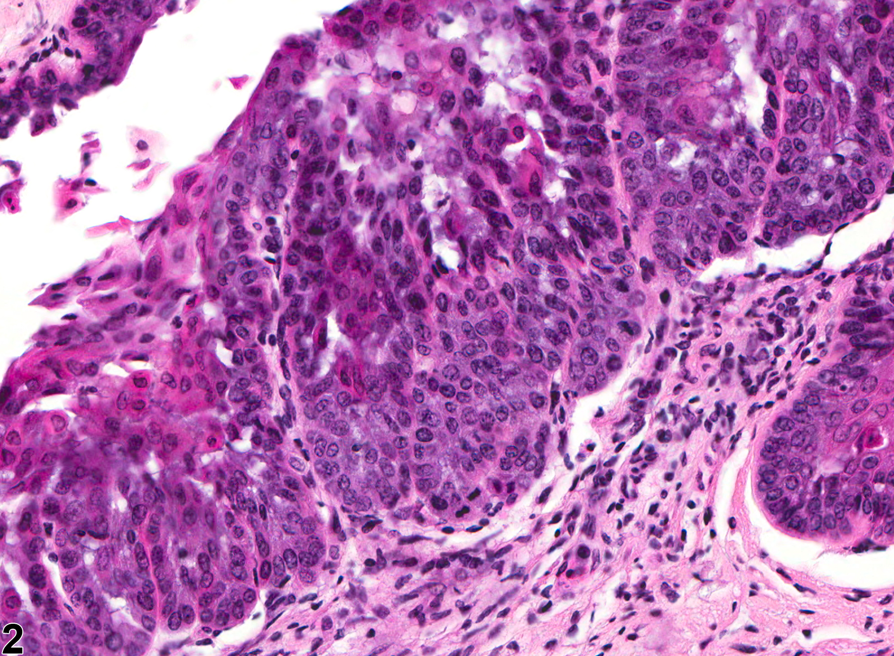 Image of hyperplasia in the vagina from a female B6C3F1 mouse in a chronic study