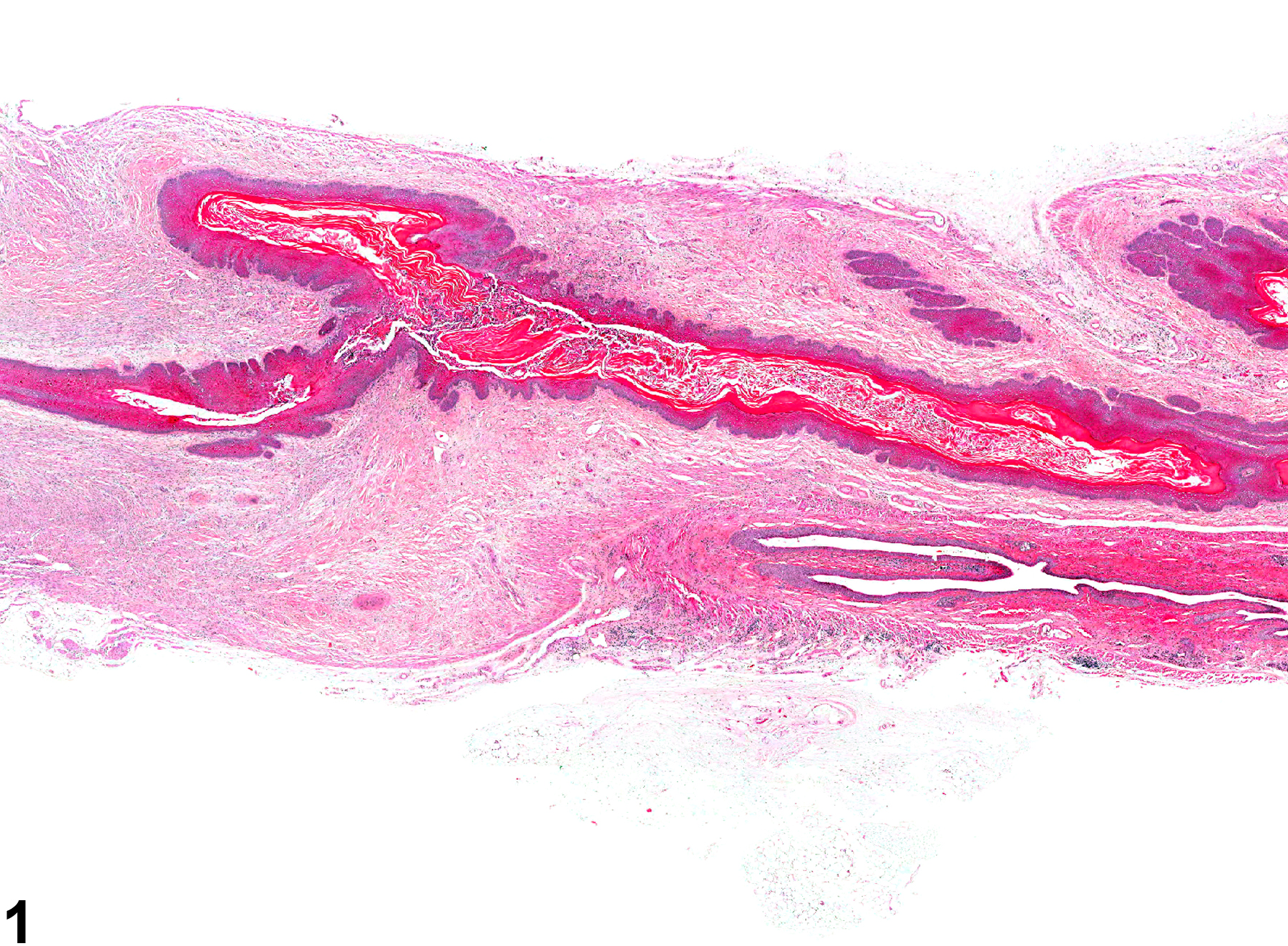 Image of fibrosis in the vagina from a female B6C3F1 mouse in a chronic study