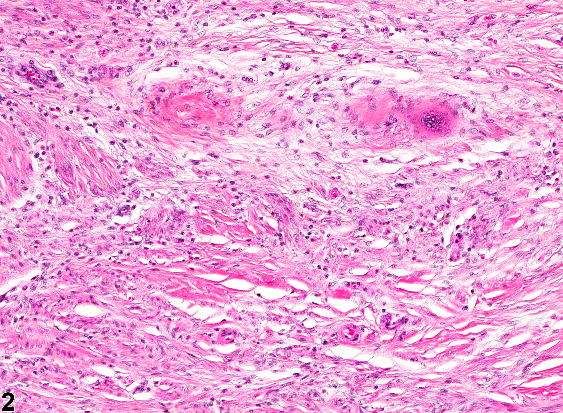 Image of fibrosis in the vagina from a female B6C3F1 mouse in a chronic study