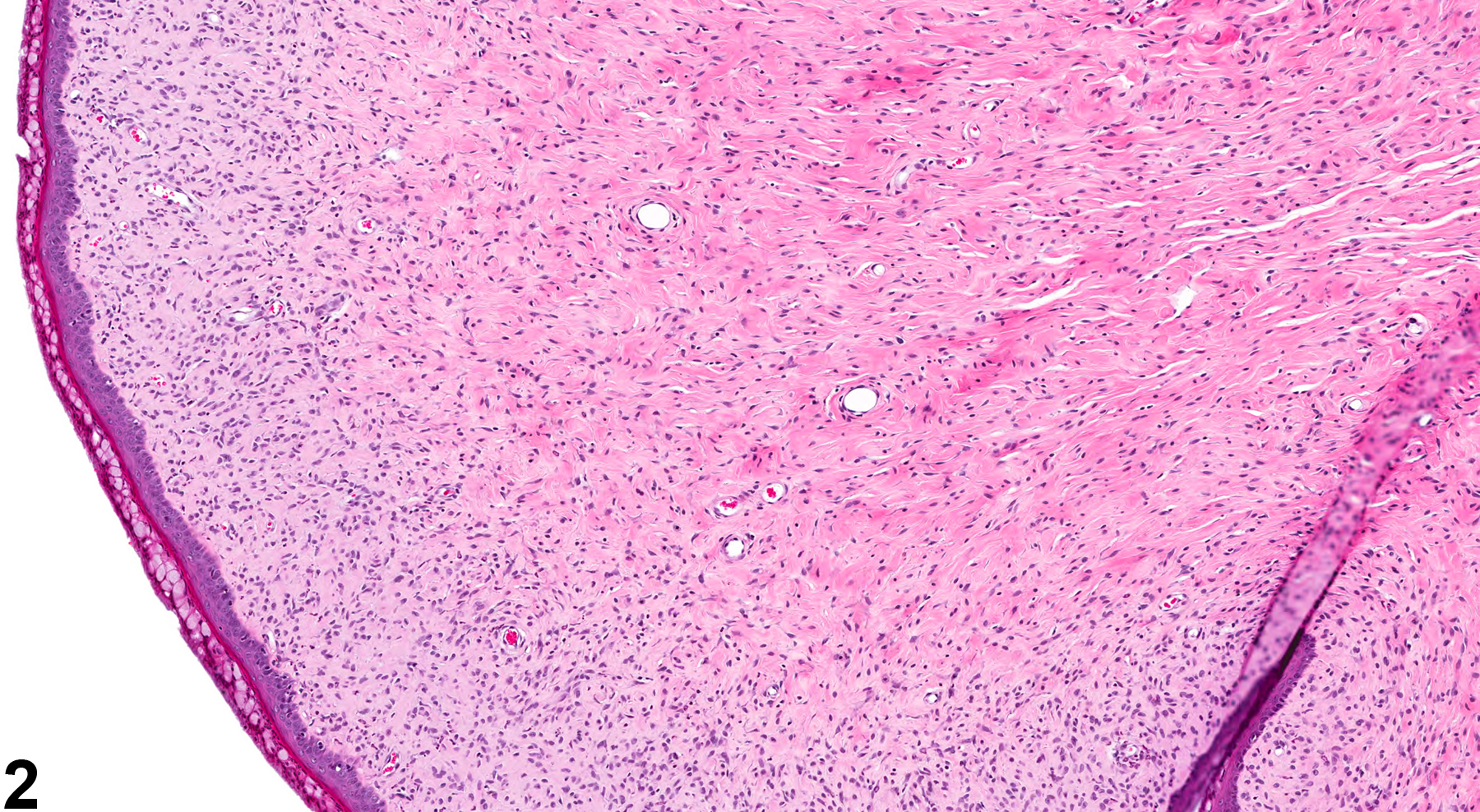 Image of hyperplasia, stromal in the vagina from a female F344/N rat in a chronic study