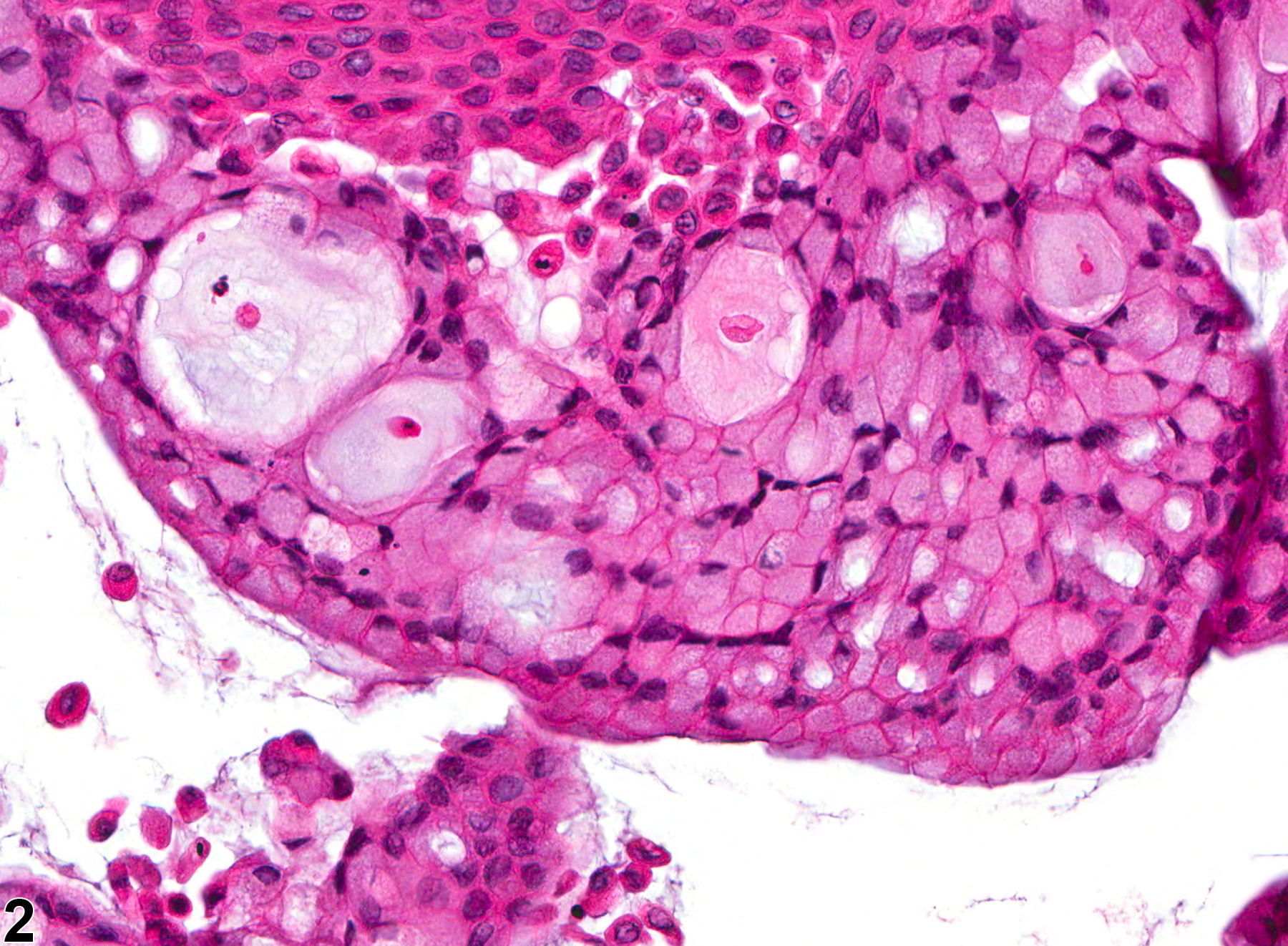 Image of mucification in the vagina from a female Harlan Sprague-Dawley rat in a chronic study