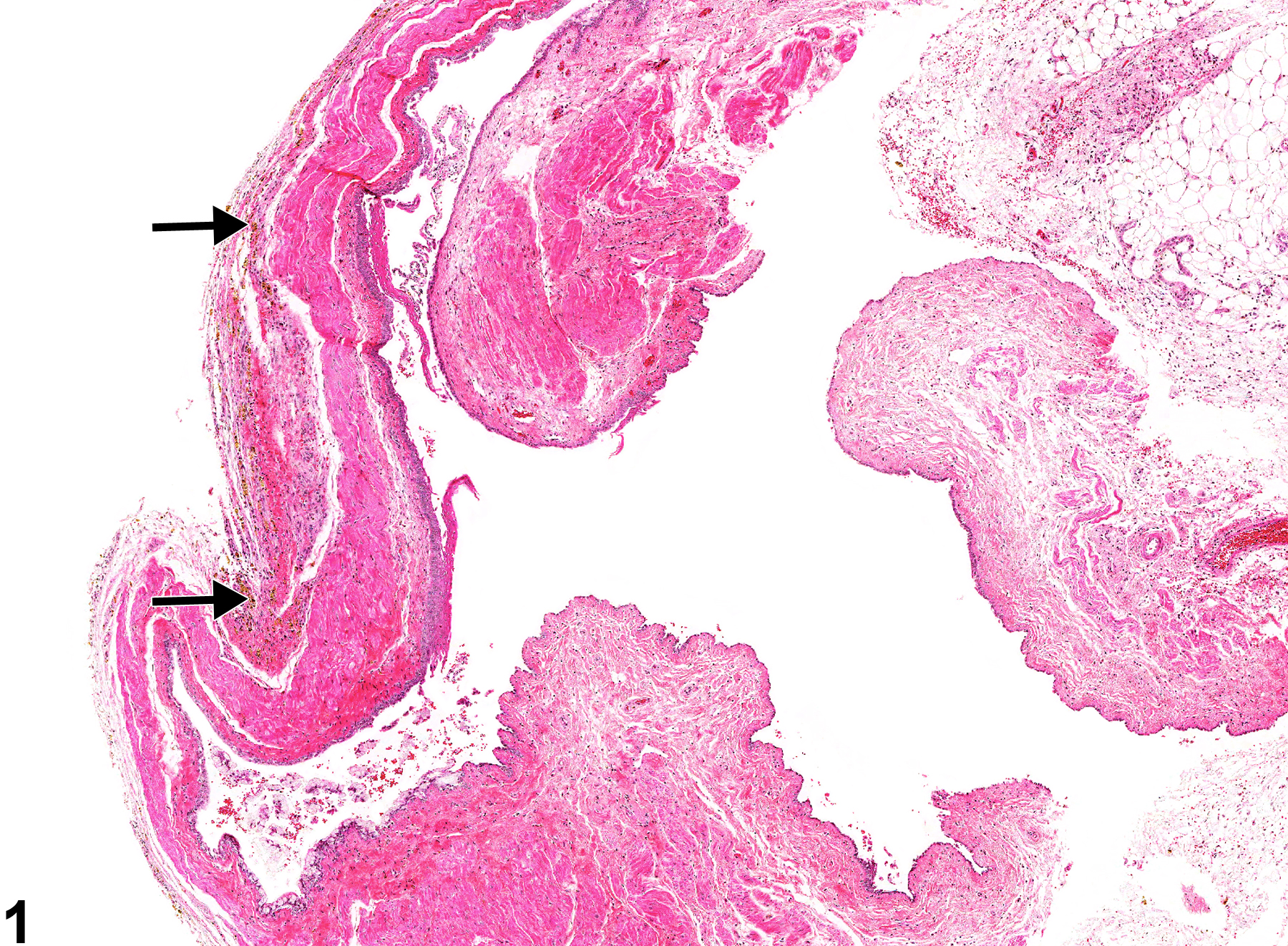 Image of pigment in the vagina from a female F344/N rat in a chronic study