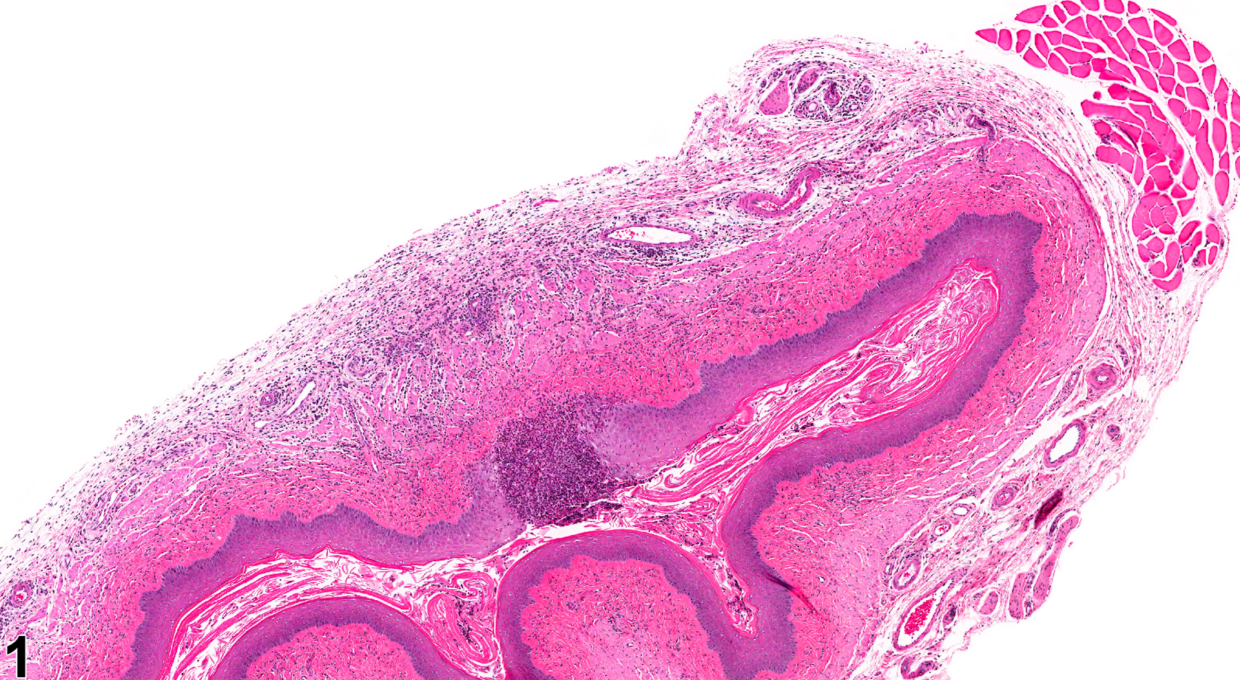 Image of ulcer in the vagina from a female Harlan Sprague-Dawley rat in a chronic study