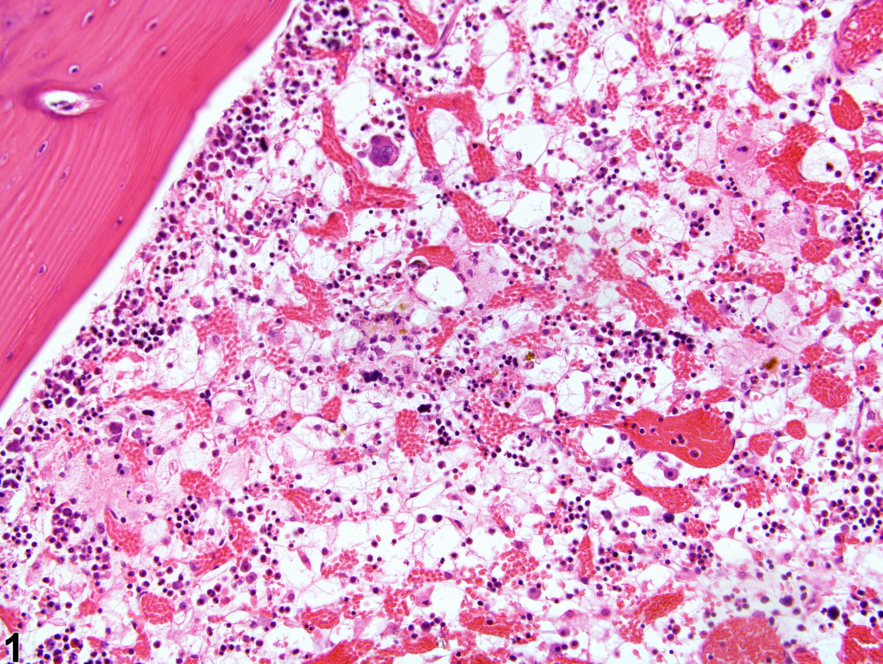 Image of gelatinous transformation in the bone marrow from a female F344/N rat in a subchronic study