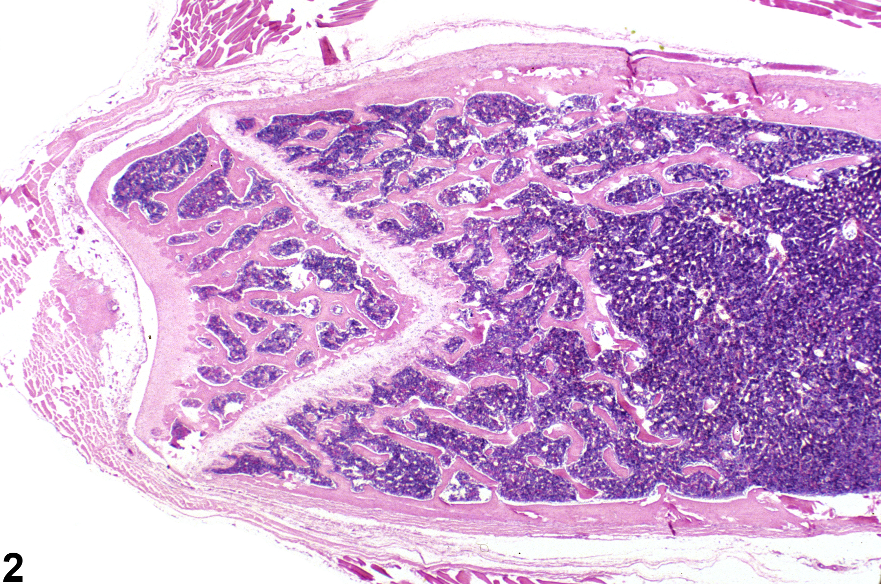Image of hypercellularity in the bone marrow from a female F344/N rat in a subchronic study