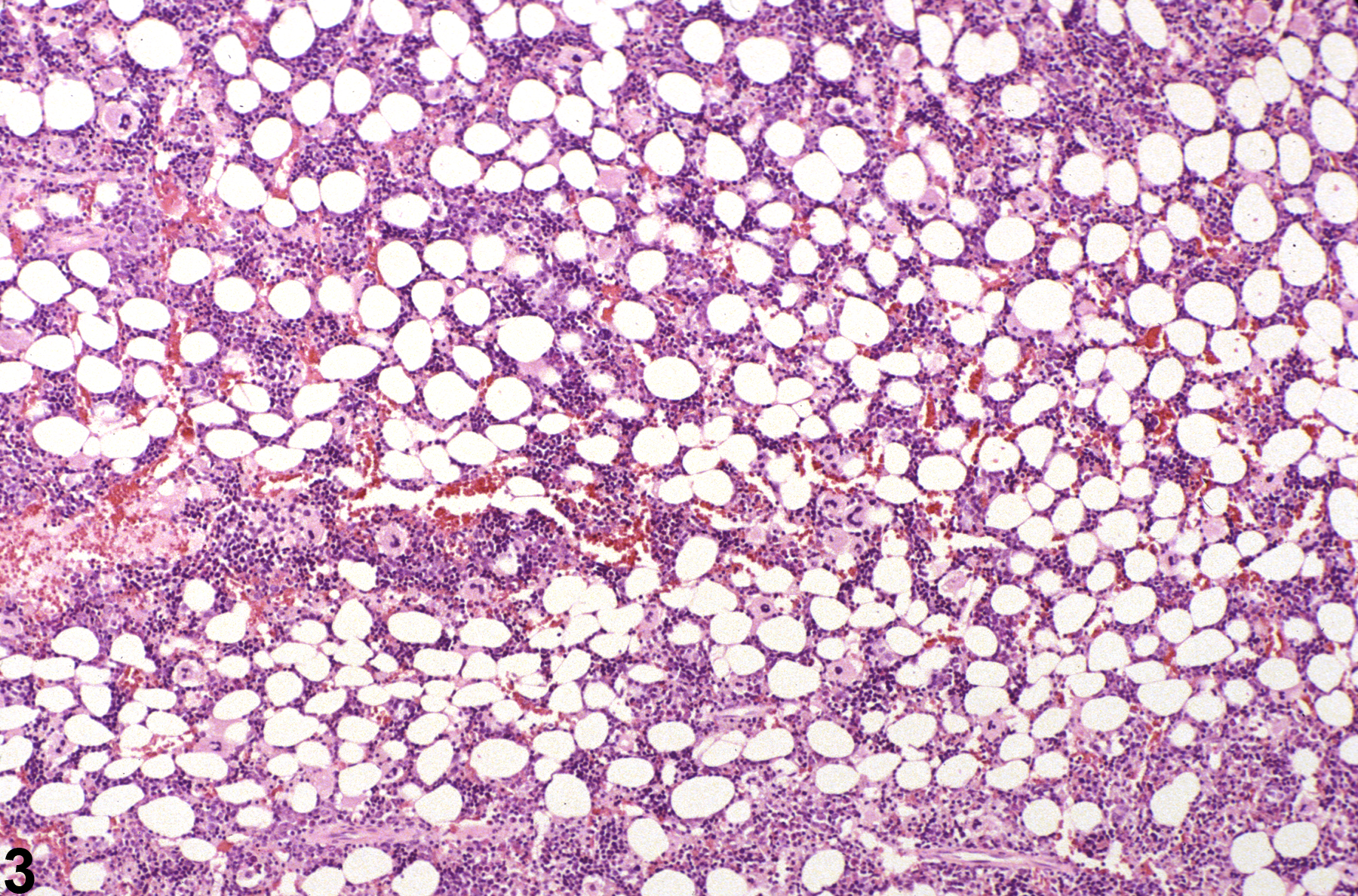 Image of hypocellularity (normal comparison) in the bone marrow from a female F344/N rat in a subchronic study