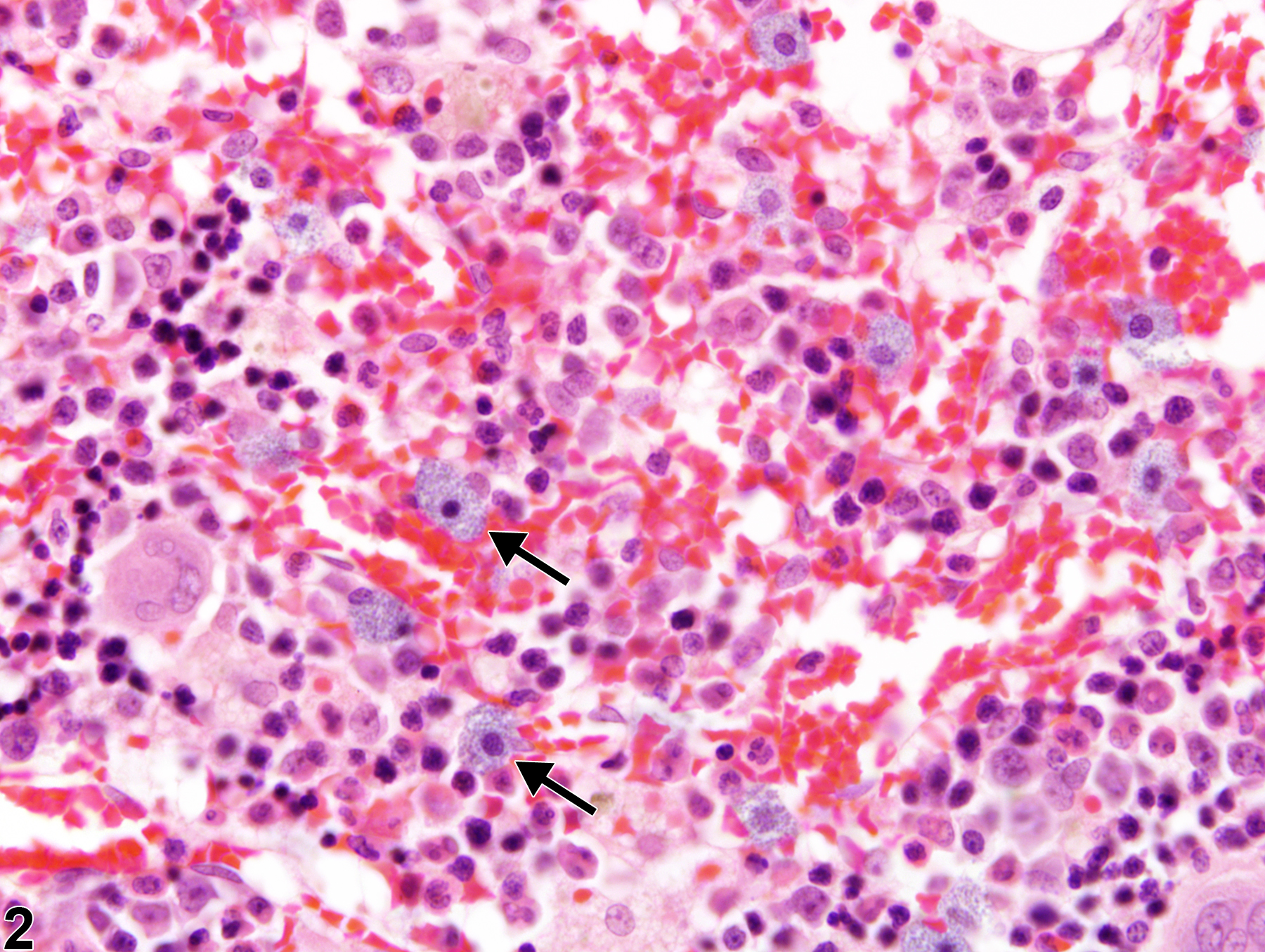 Image of infiltration cellular, mast cell in the bone marrow from a female F344/N rat in a chronic study