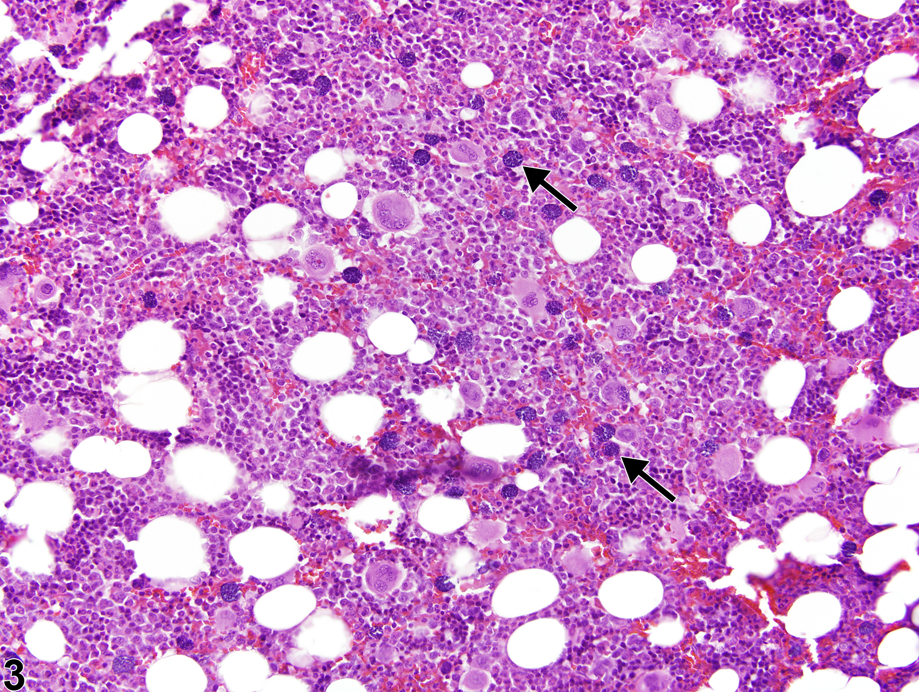 Image of infiltration cellular, mast cell in the bone marrow from a male F344/N rat in a chronic study