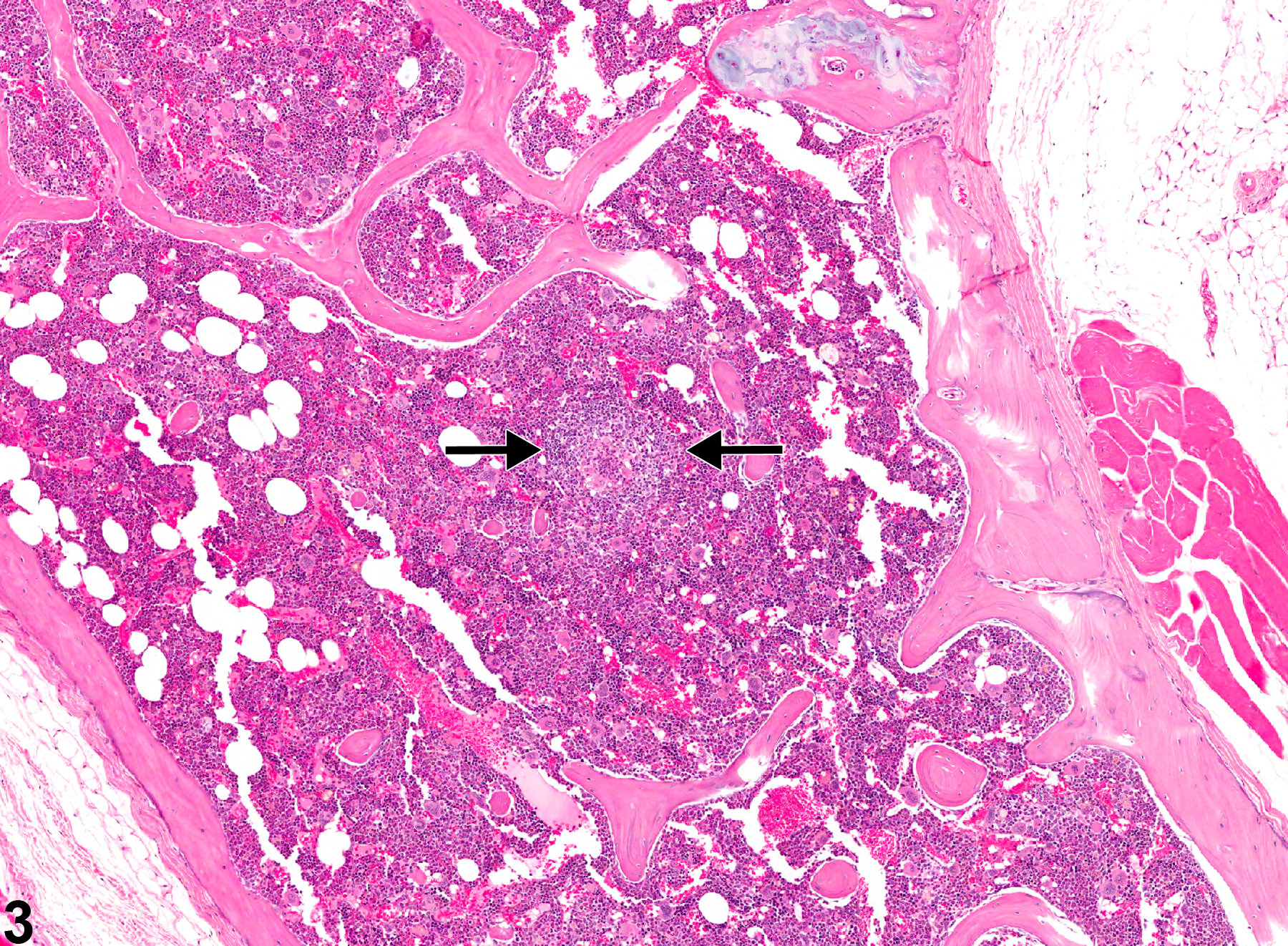 Image of inflammation in the bone marrow from a male B6C3F1 mouse in a chronic study