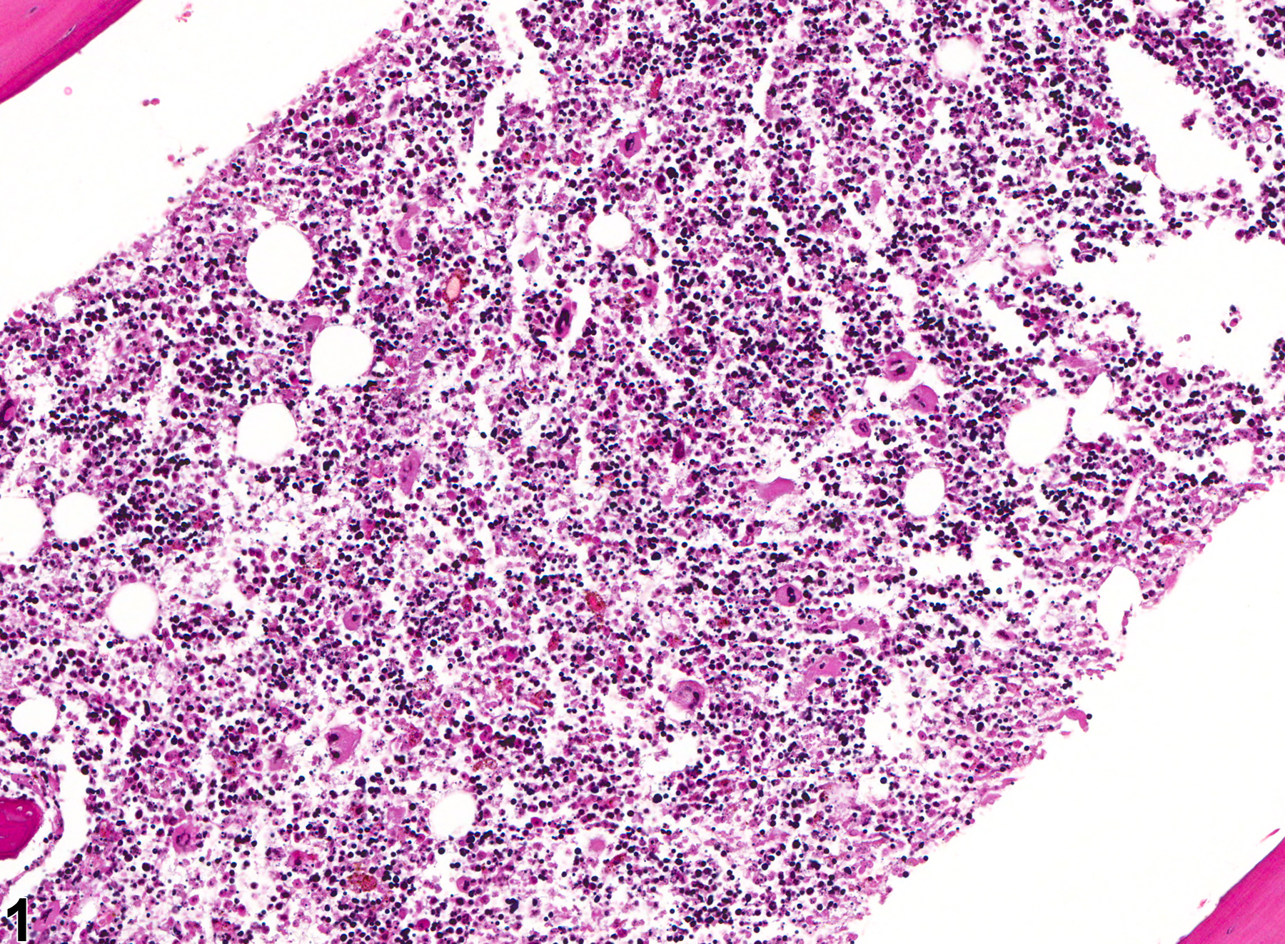 Image of necrosis in the bone marrow from a female B6C3F1 mouse in a chronic study