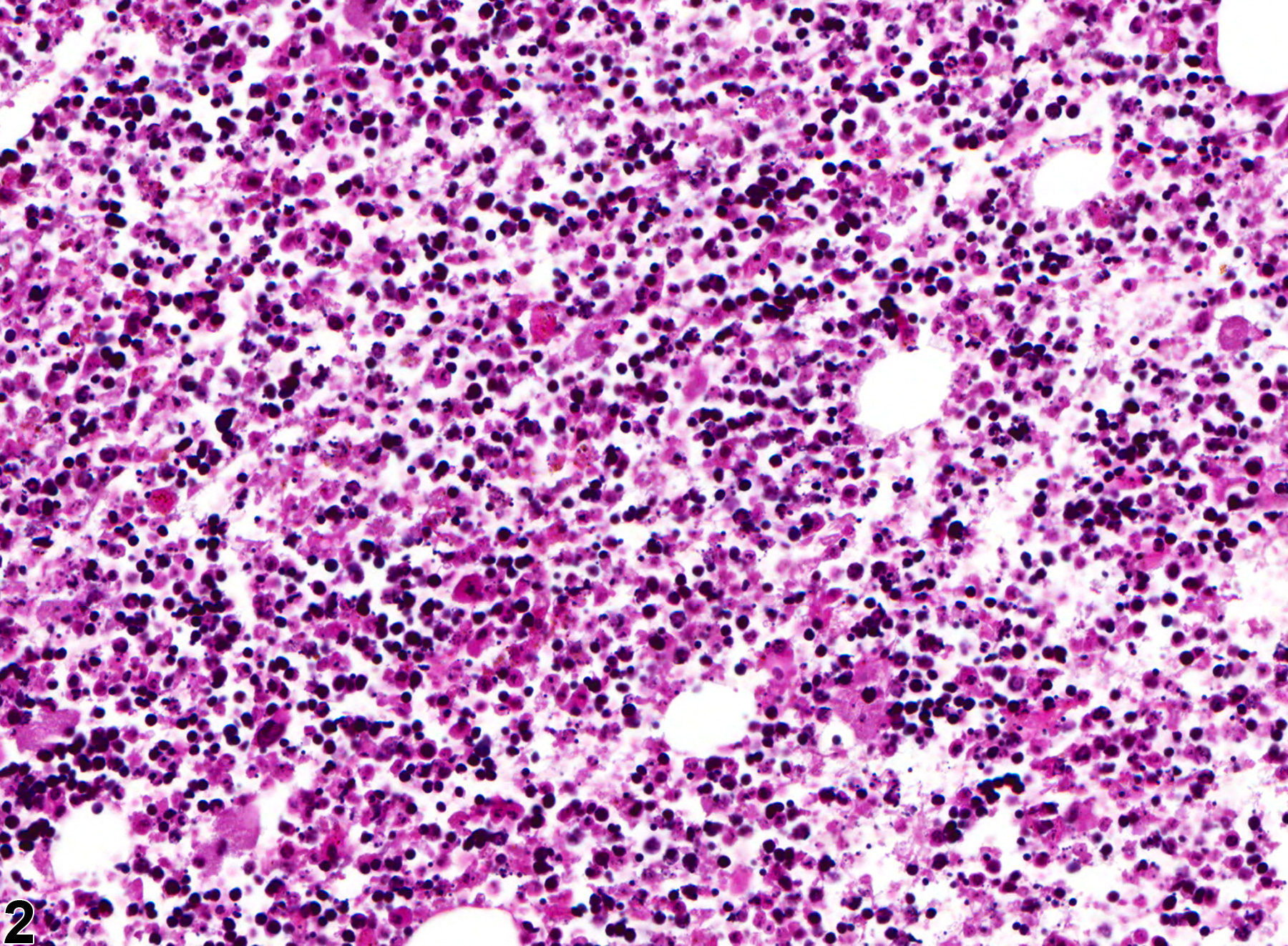 Image of necrosis in the bone marrow from a female B6C3F1 mouse in a chronic study