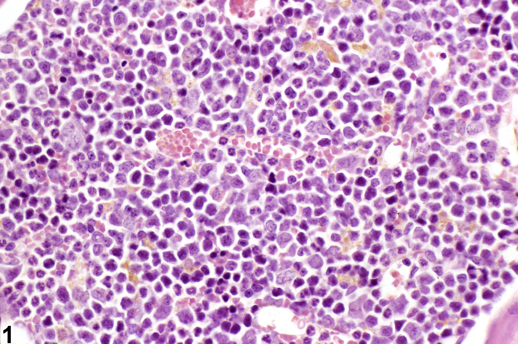 Image of pigment in the bone marrow from a male B6C3F1 mouse in a subchronic study