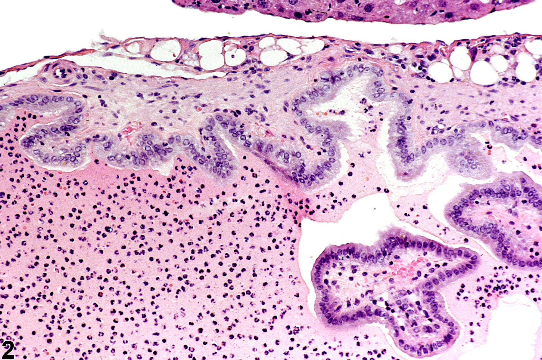 Image of inflammation in the gallbladder from a female B6C3F1 mouse in a chronic study